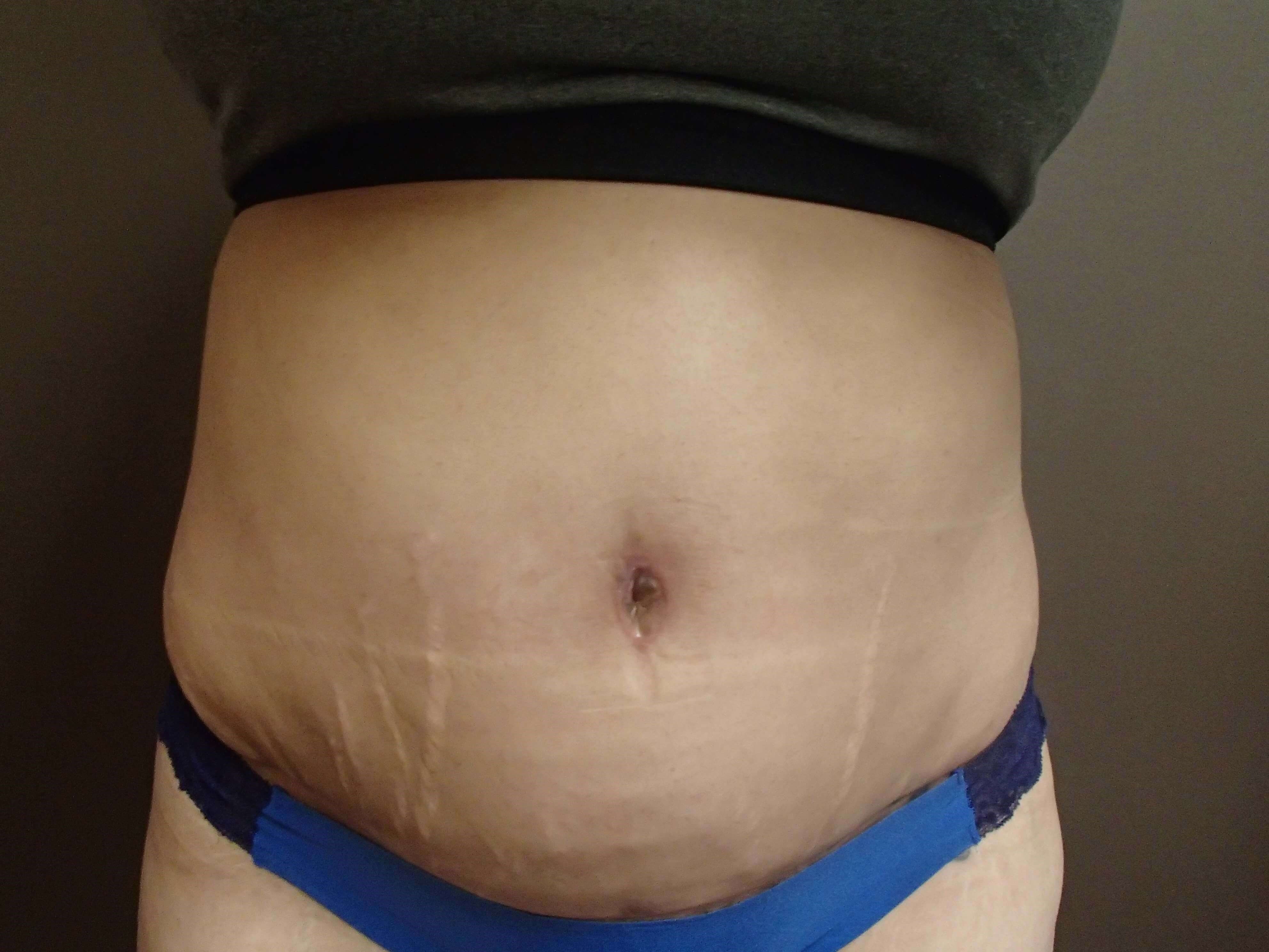 Before Image