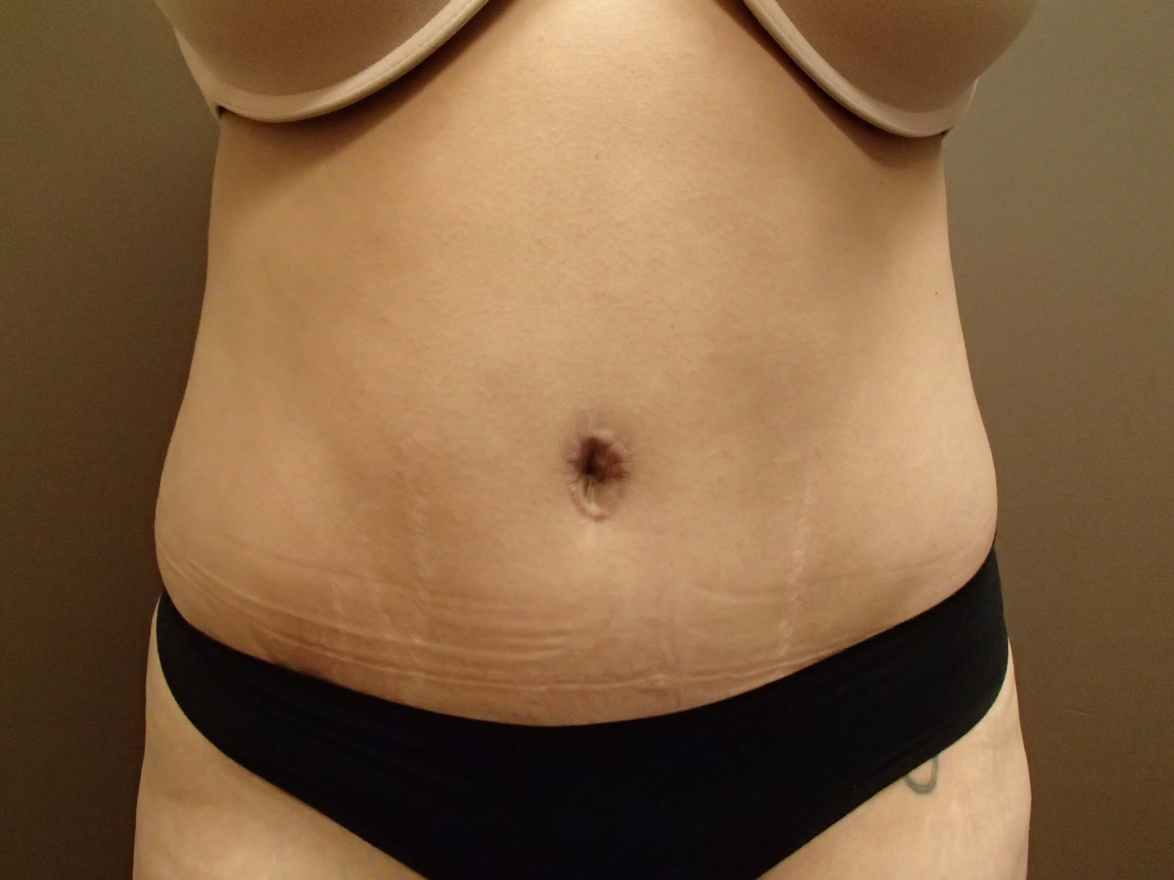 After Image