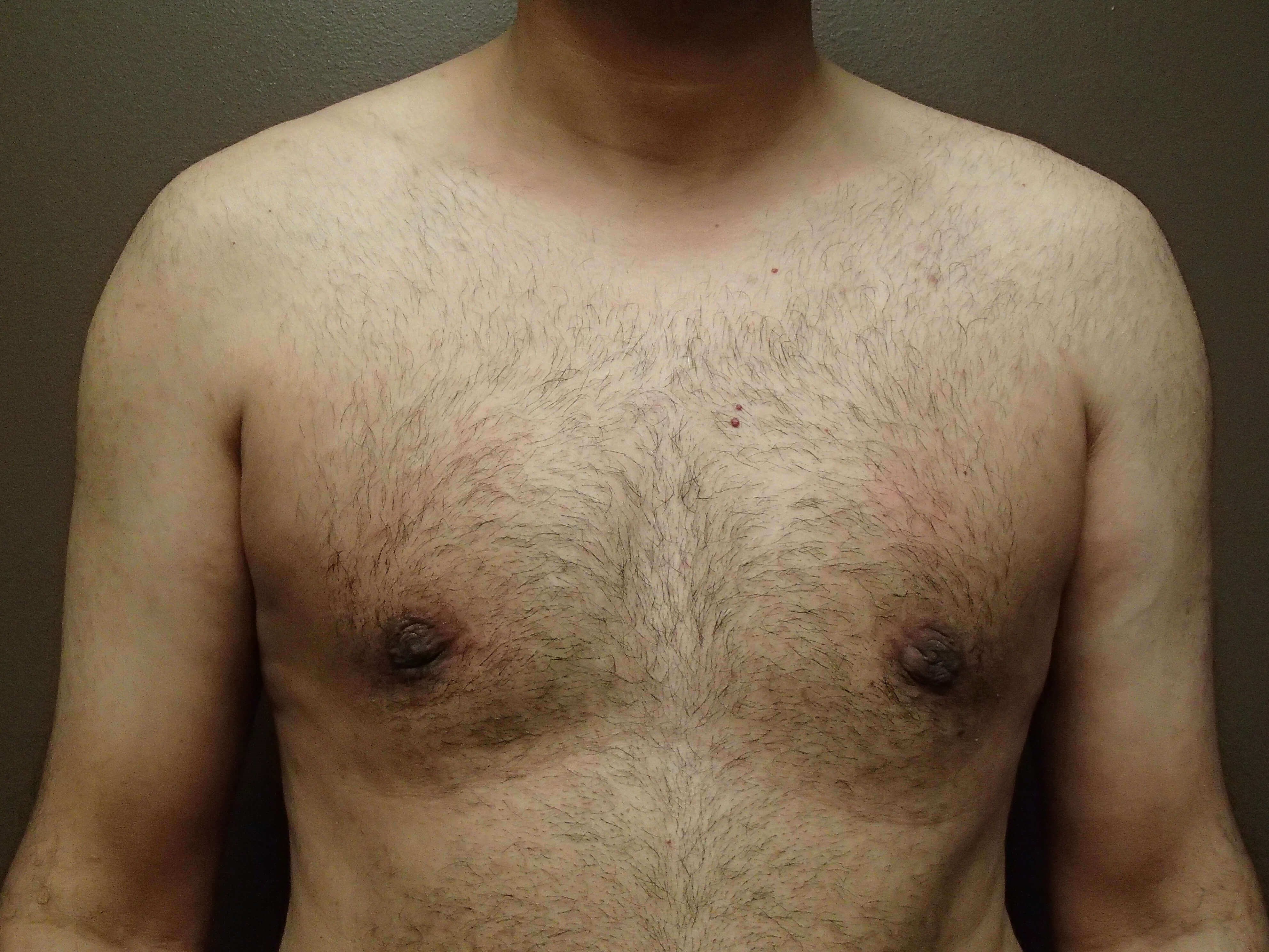After Image