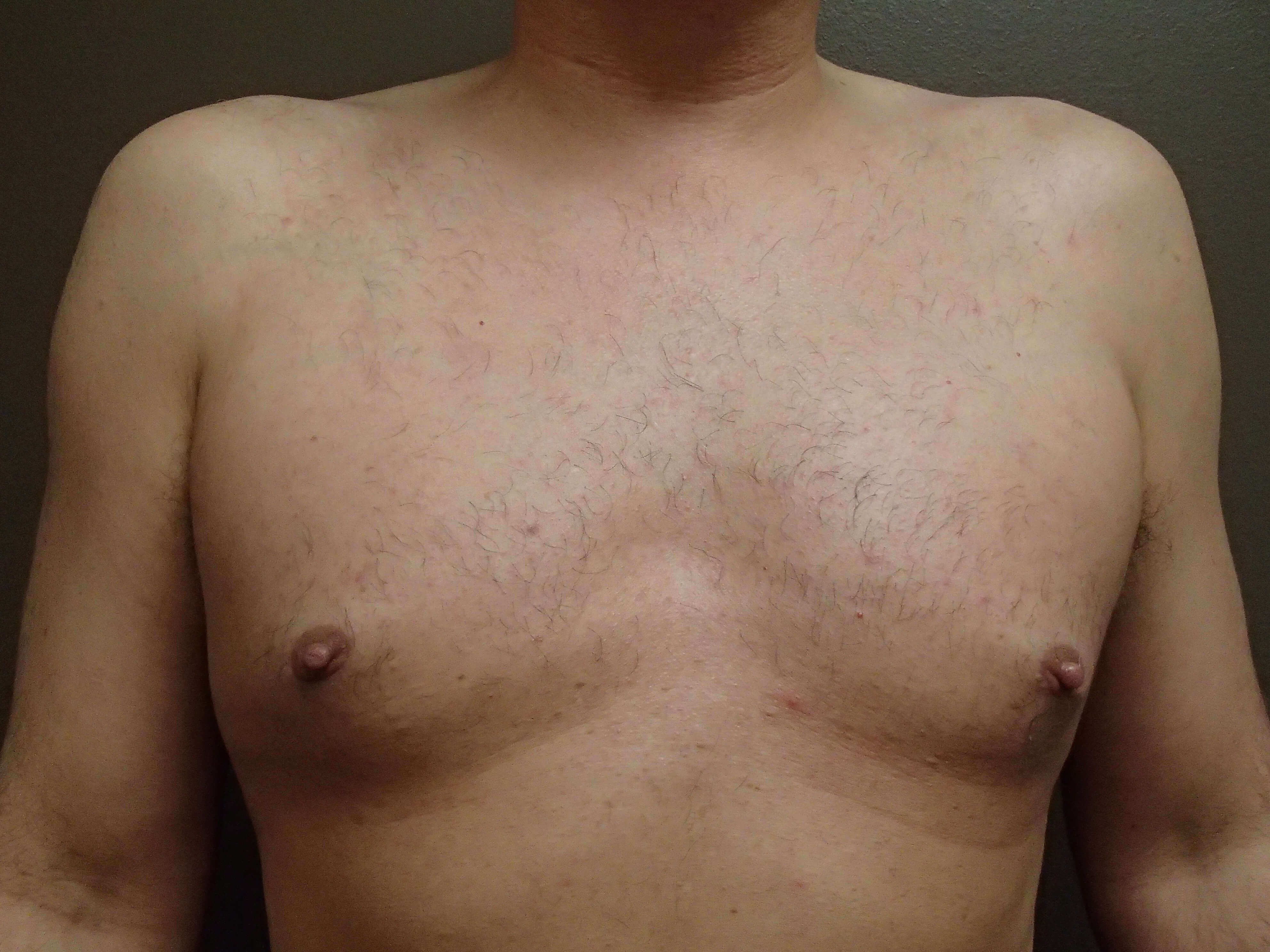 After Image