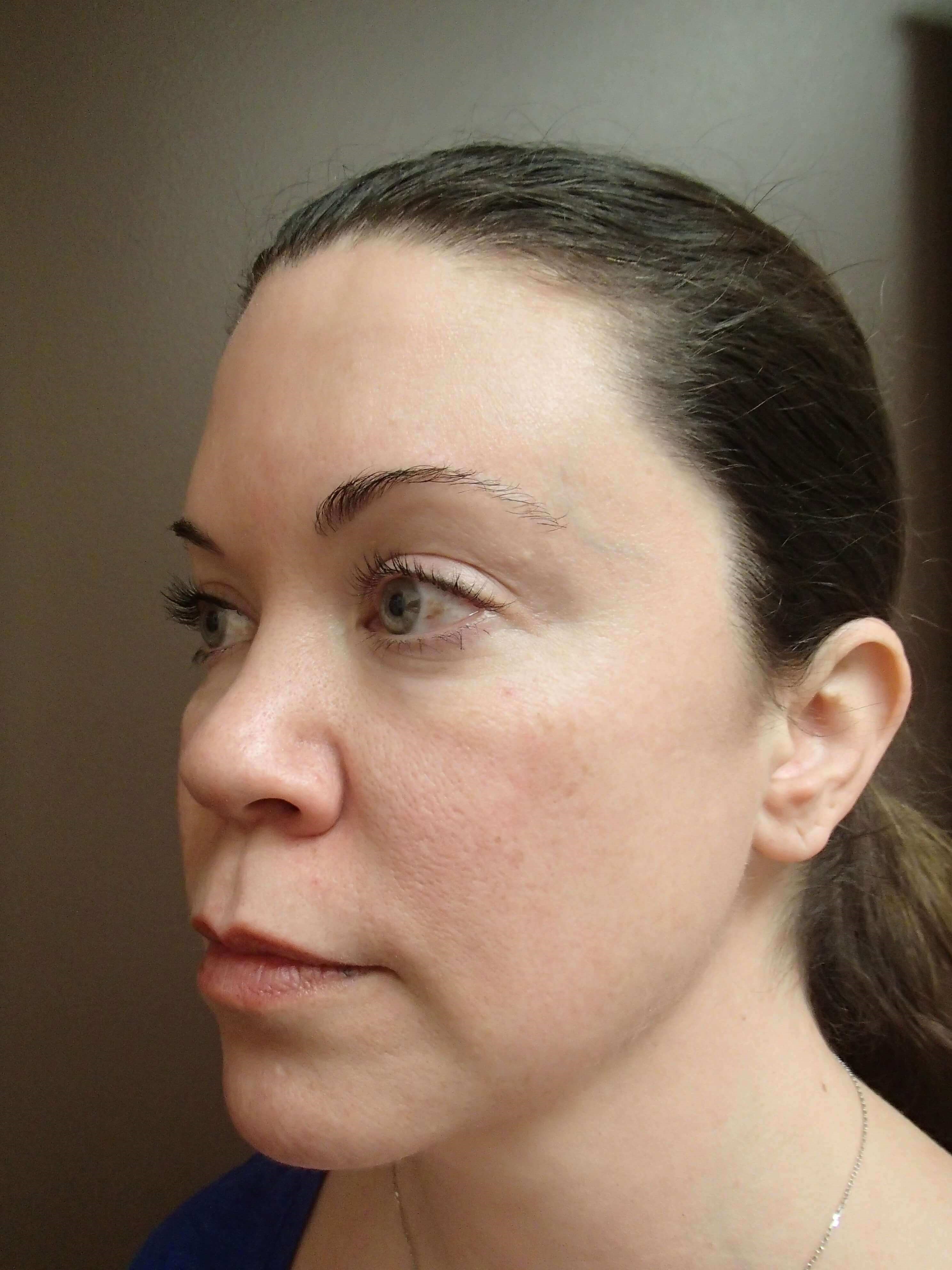 Before Image