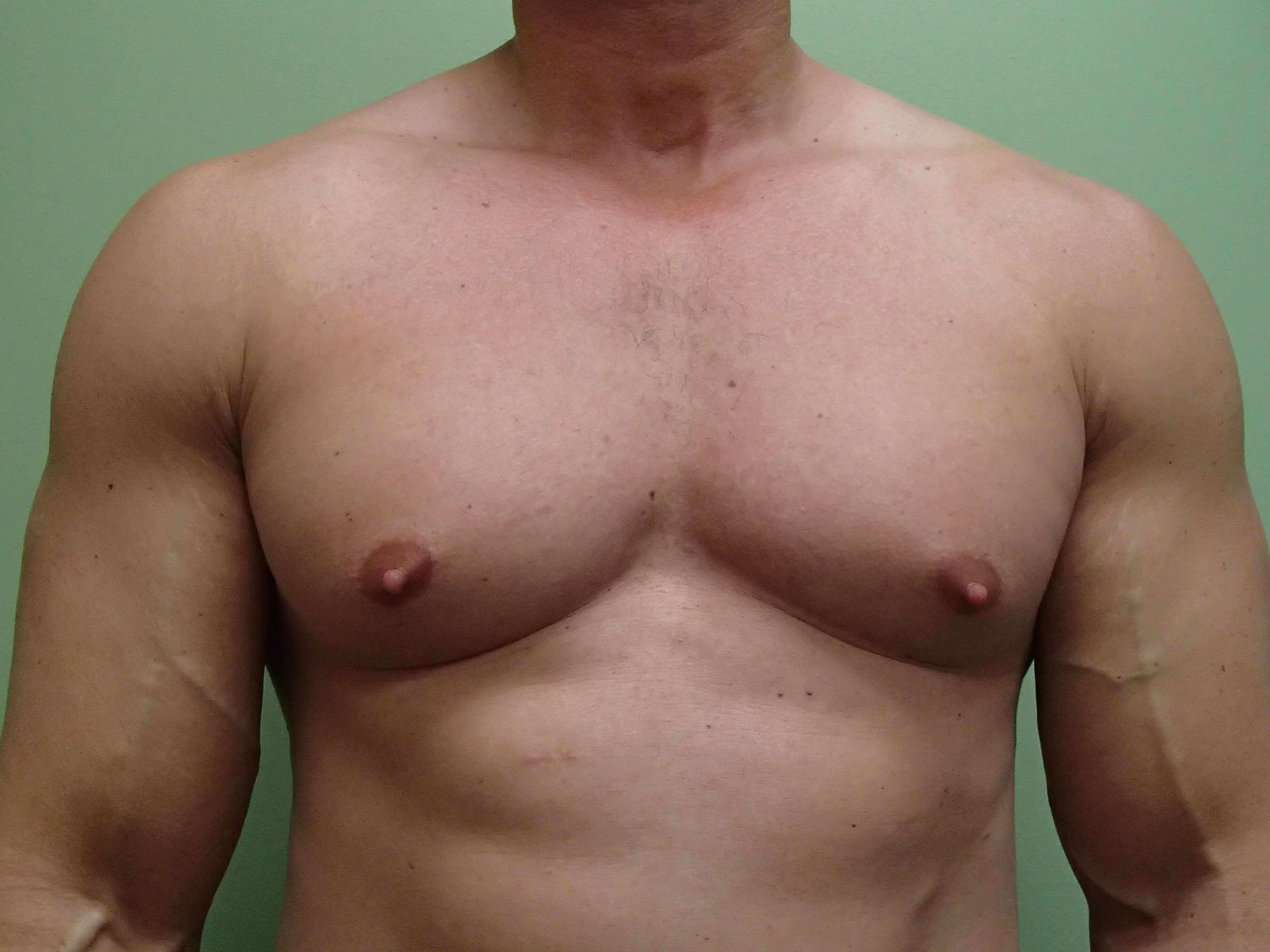 Before Image