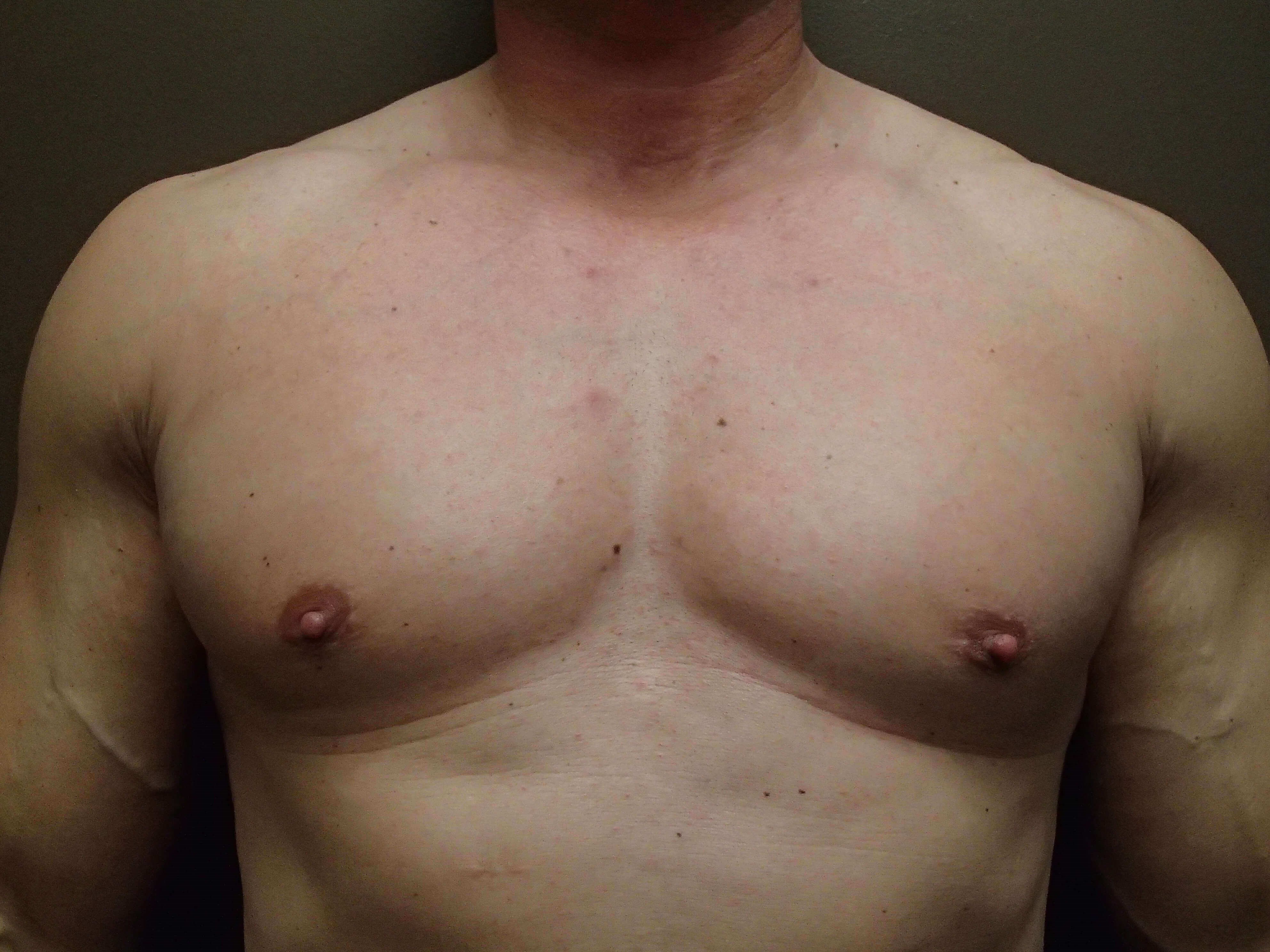 After Image