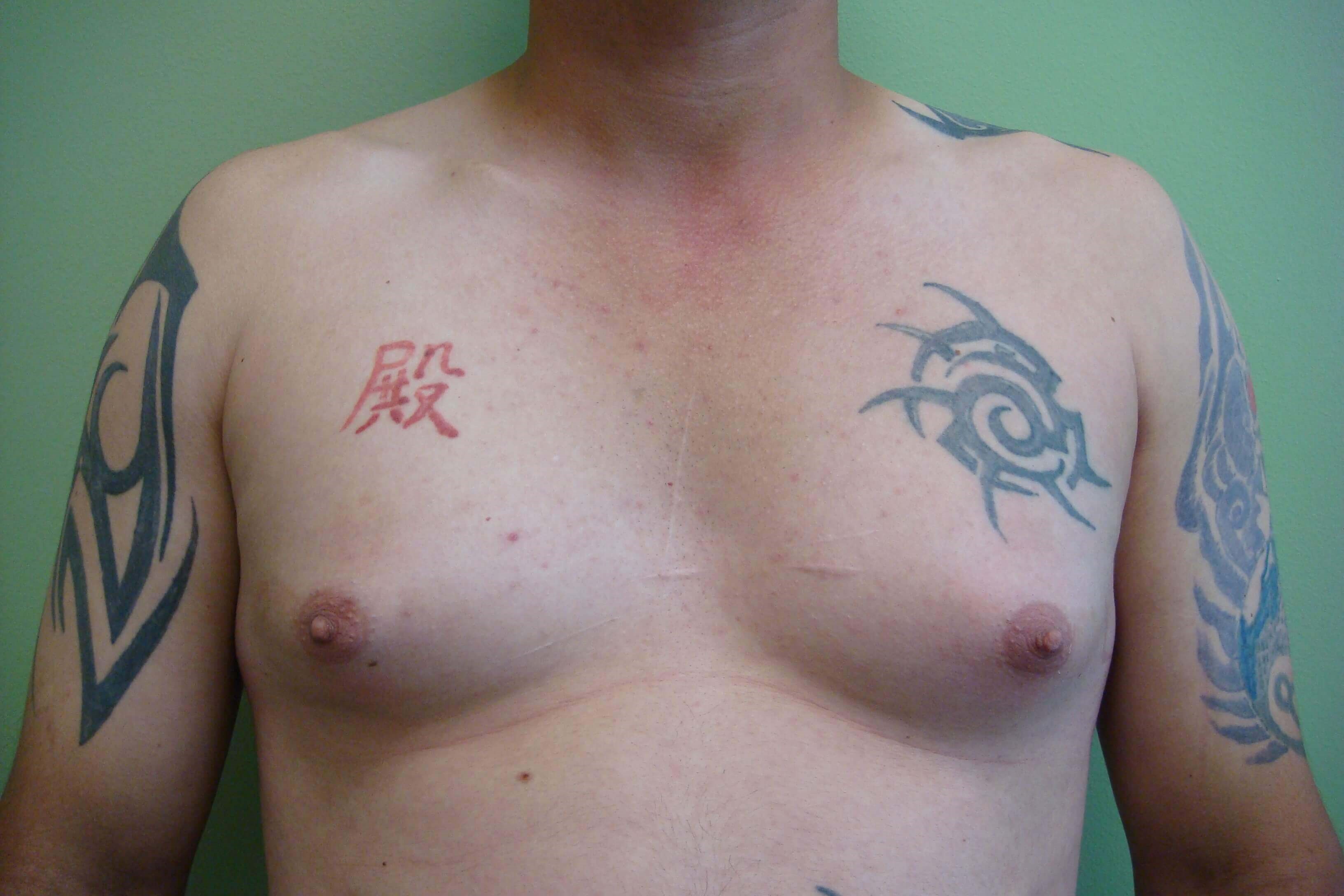 Before Image