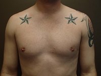 After Image