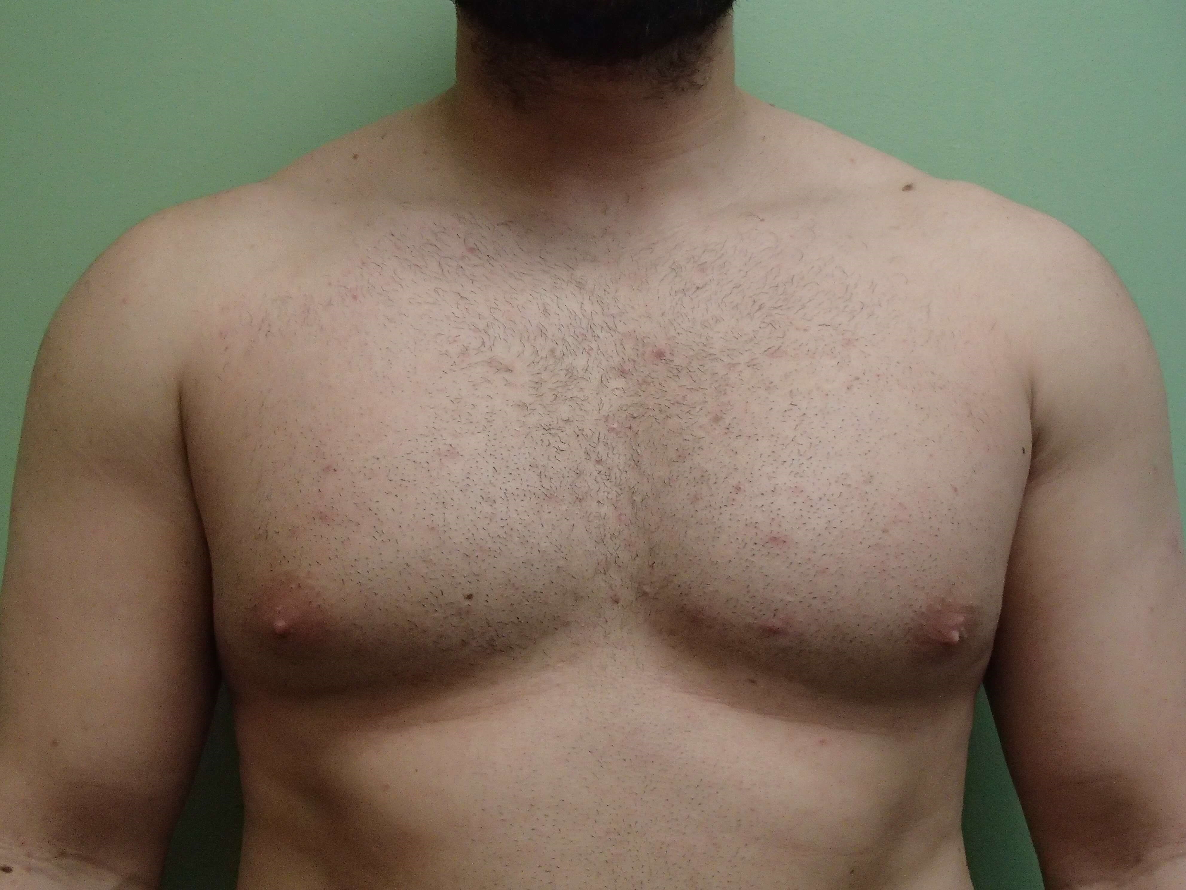 Before Image
