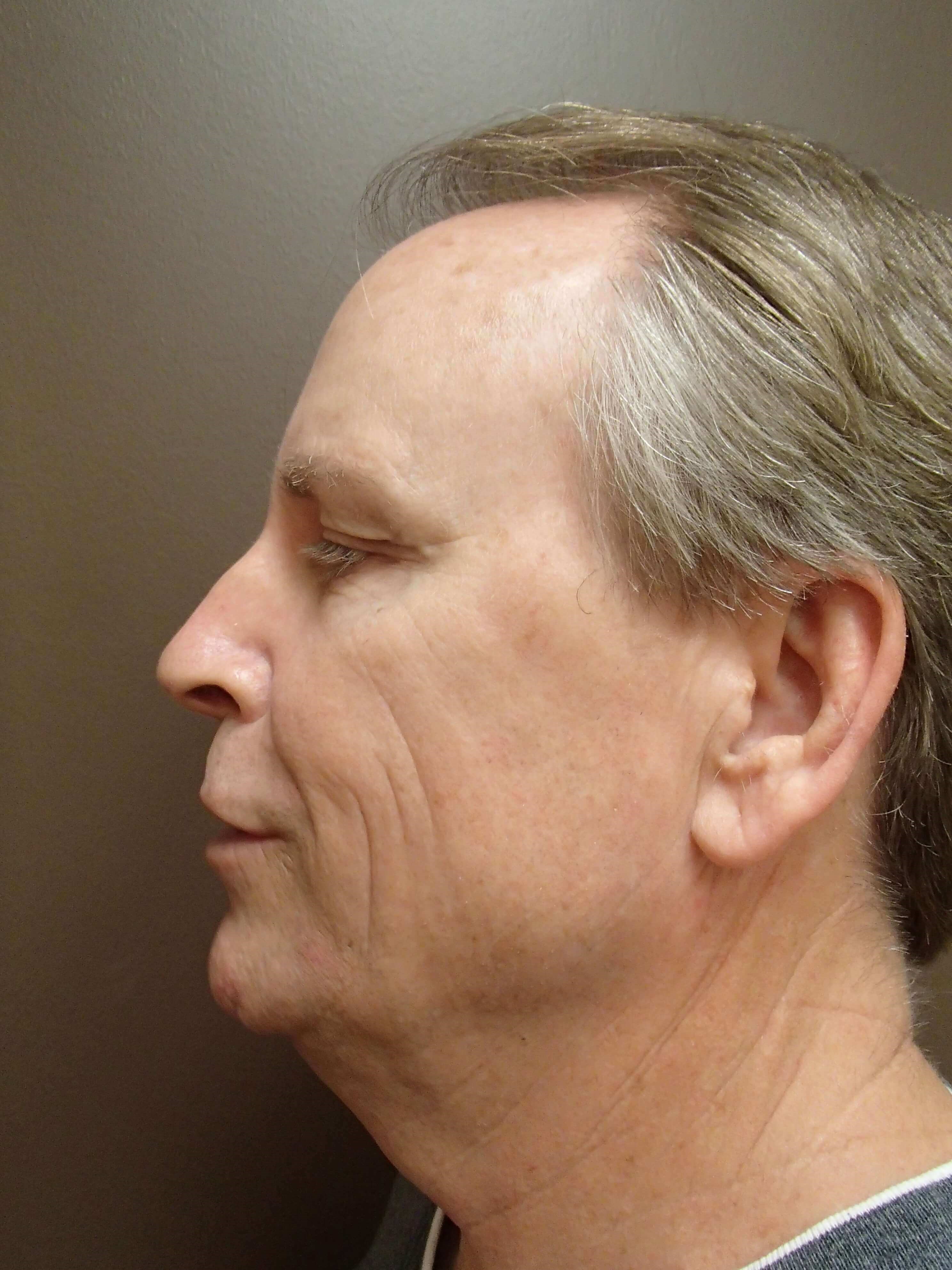 Before Image