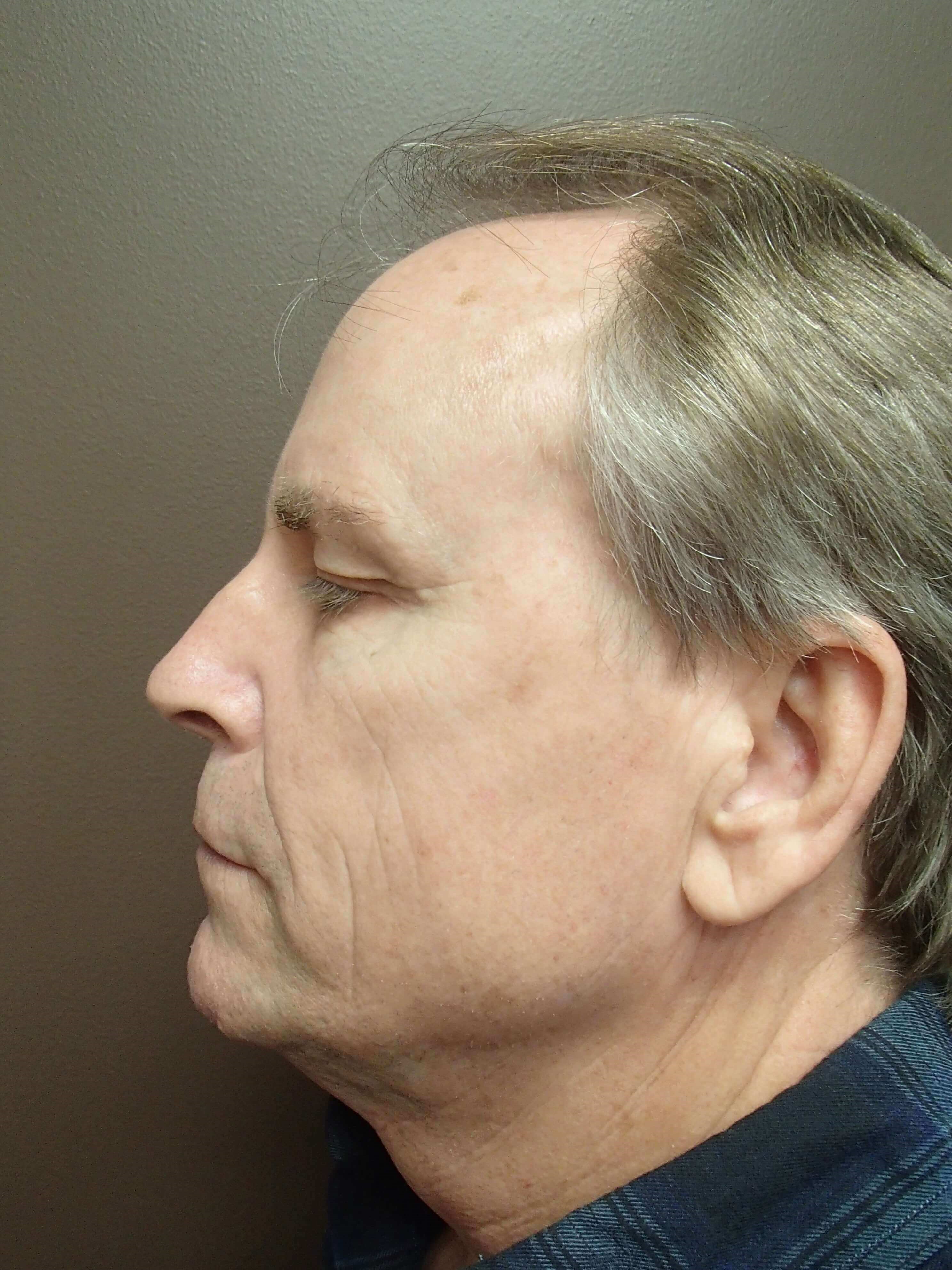 After Image