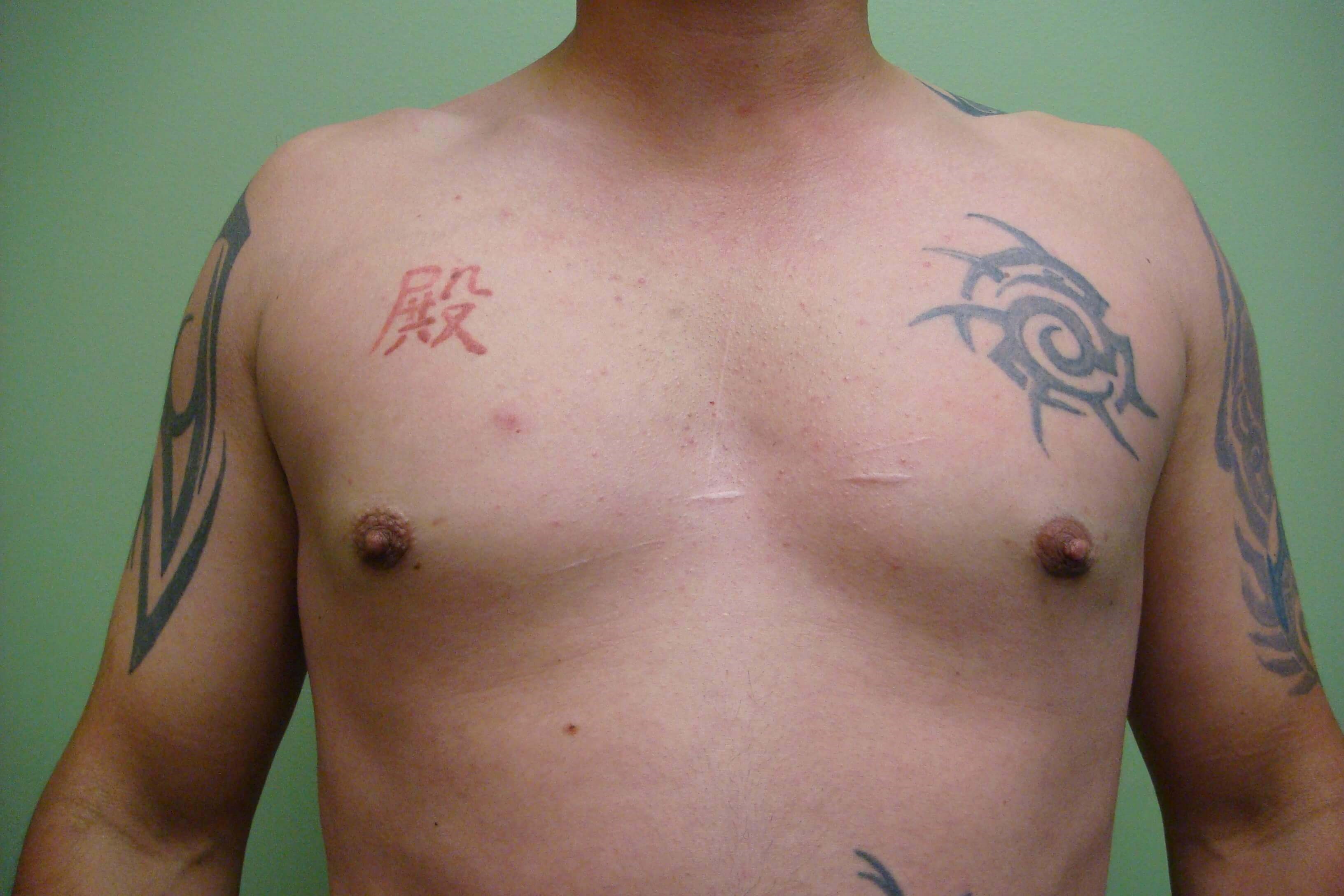 After Image
