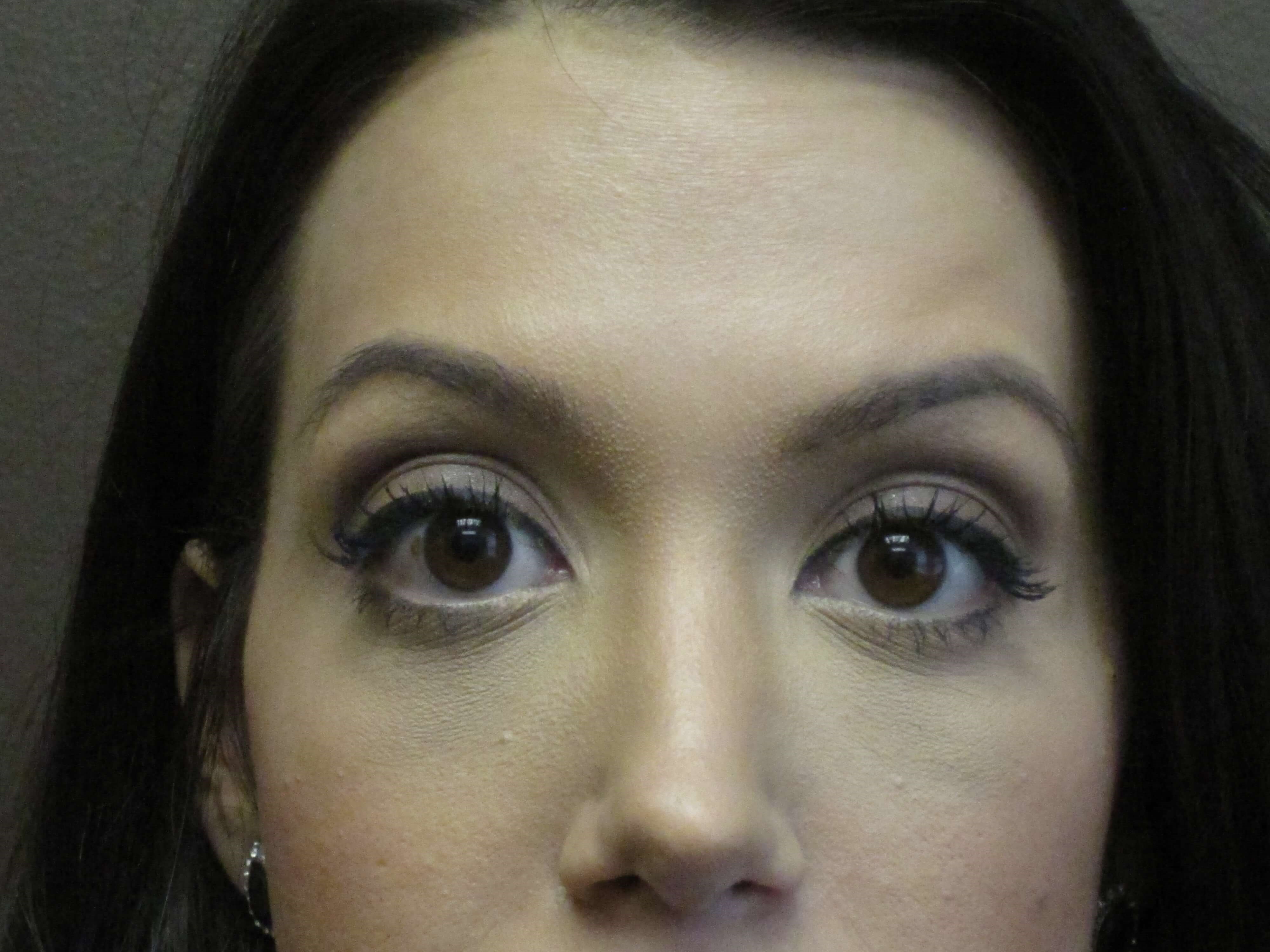 Botox After