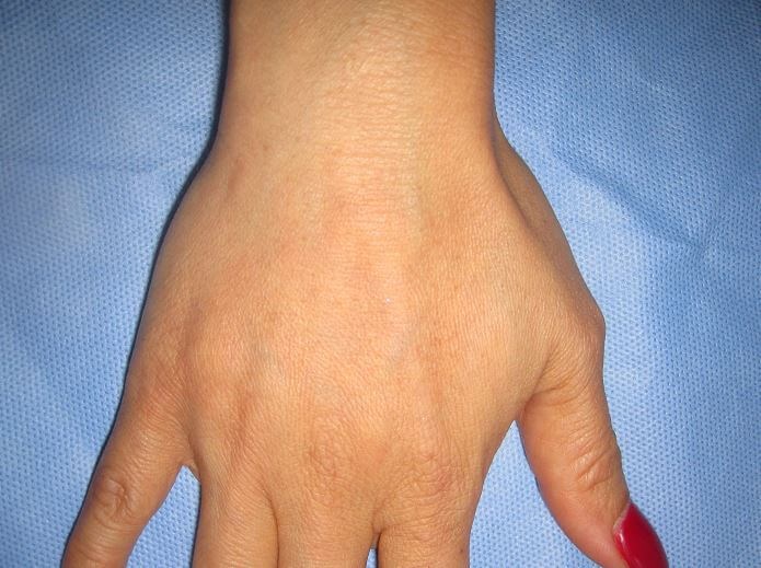 After Image