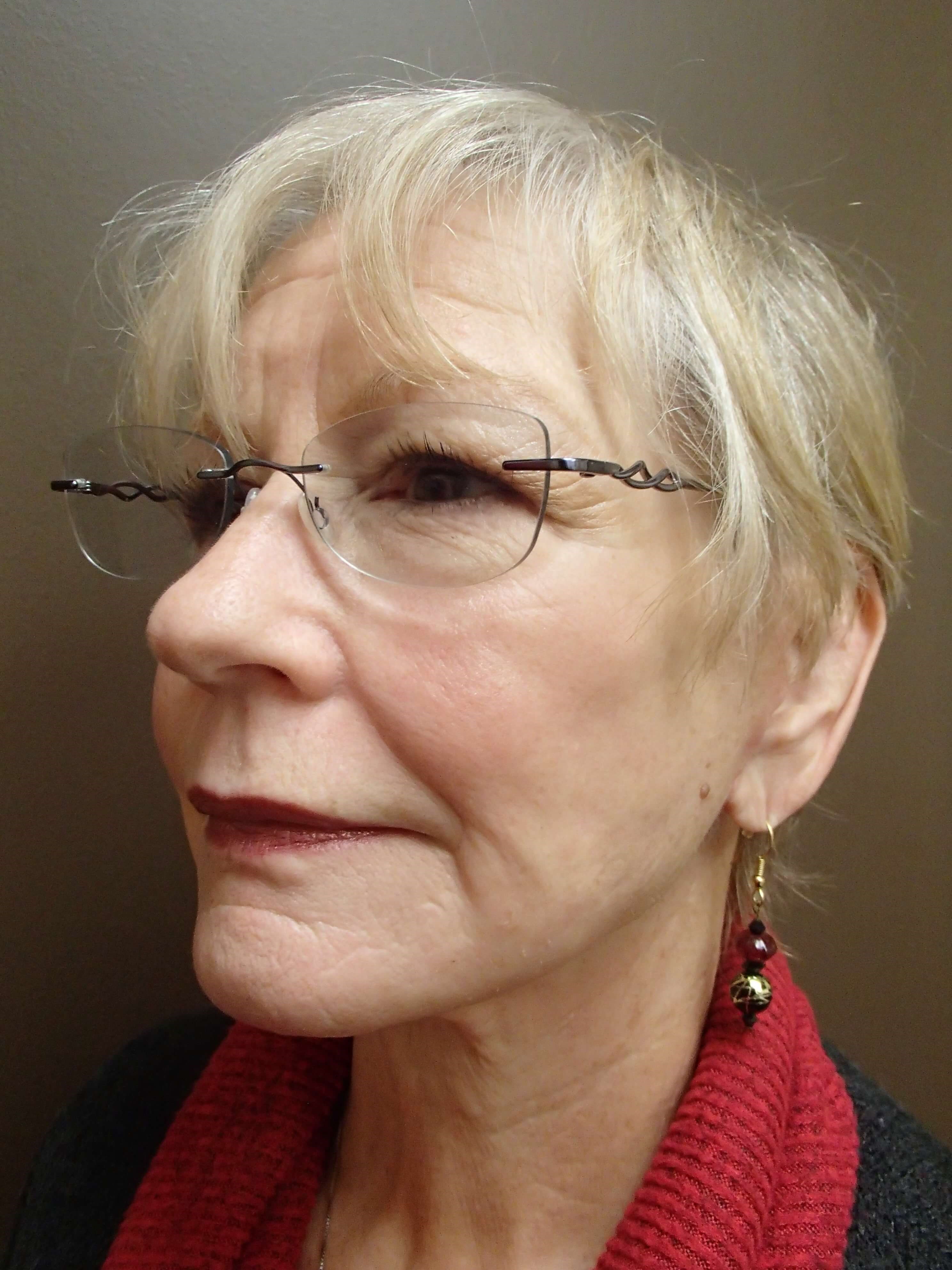 Faclift/Necklift After