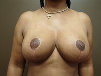 After Image