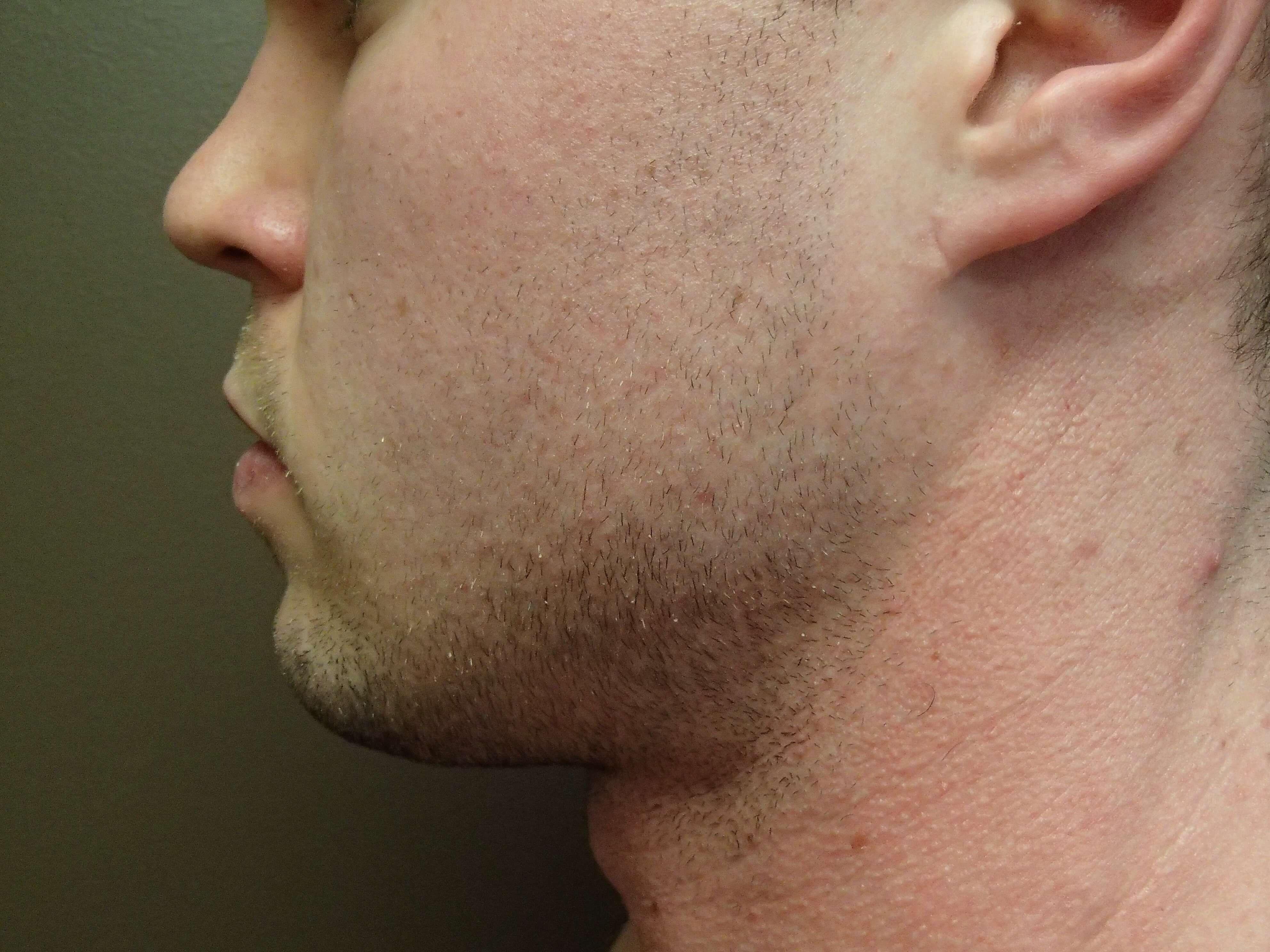 After Image