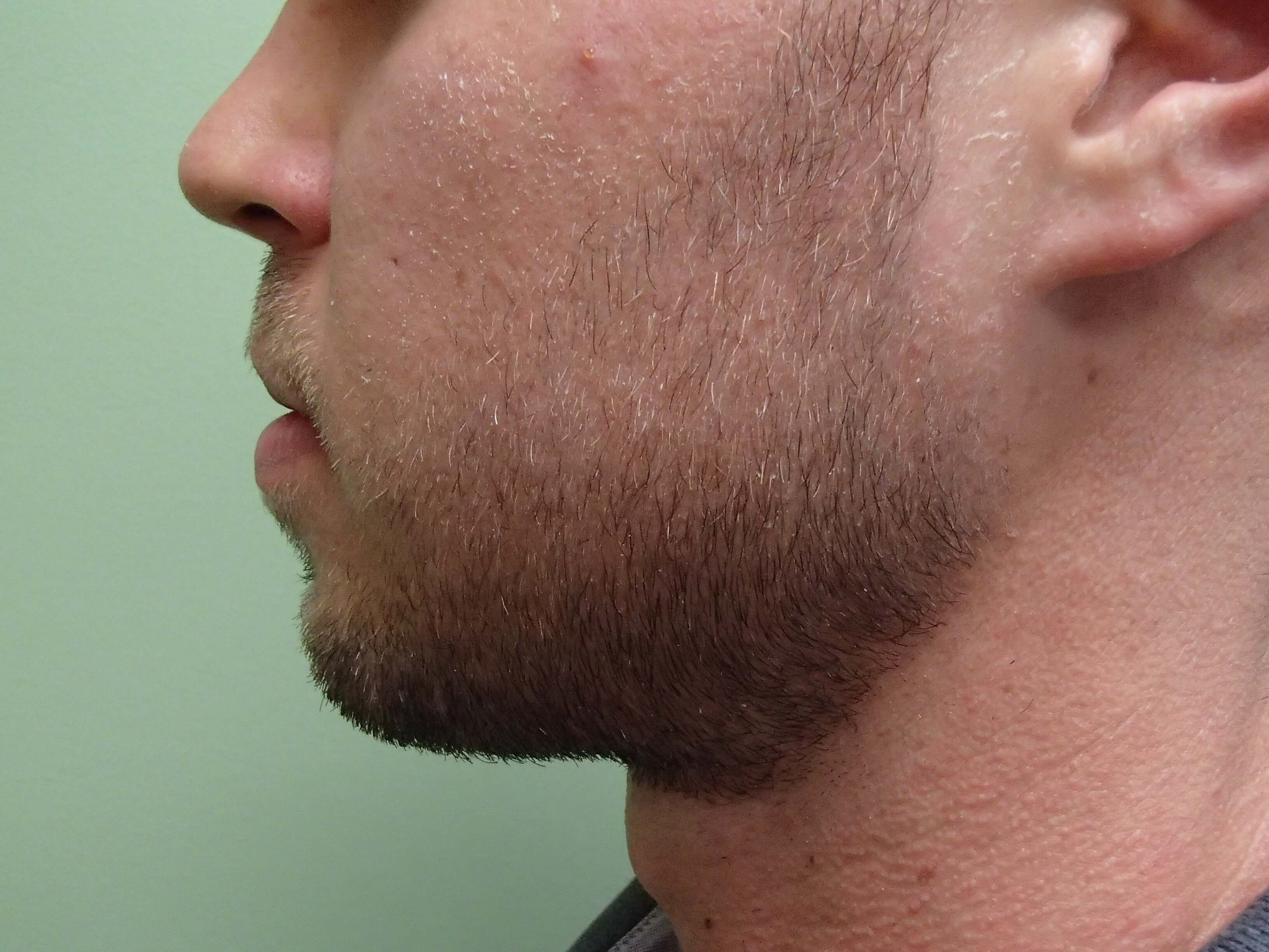 Before Image