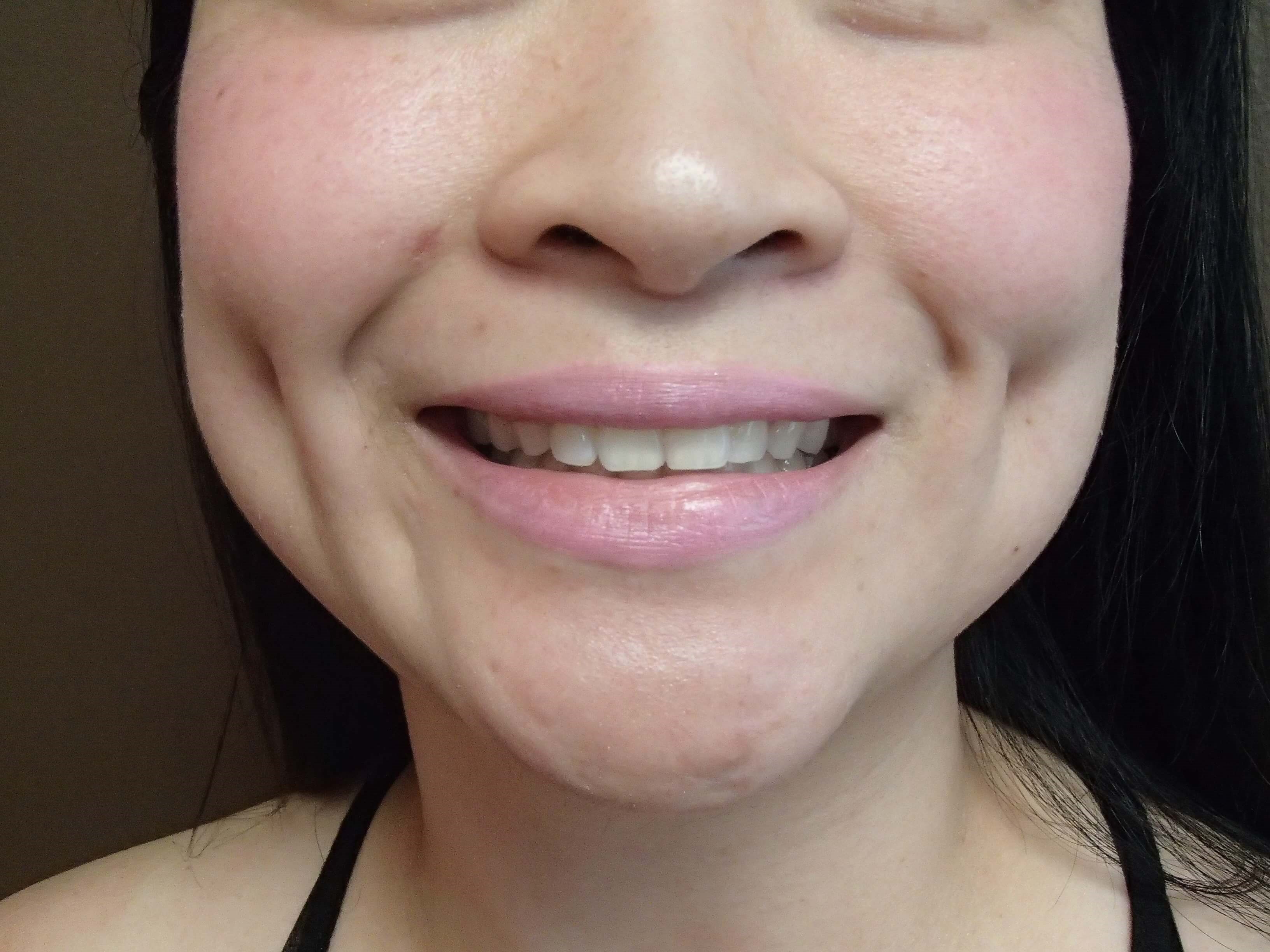 Timeless Dimple After