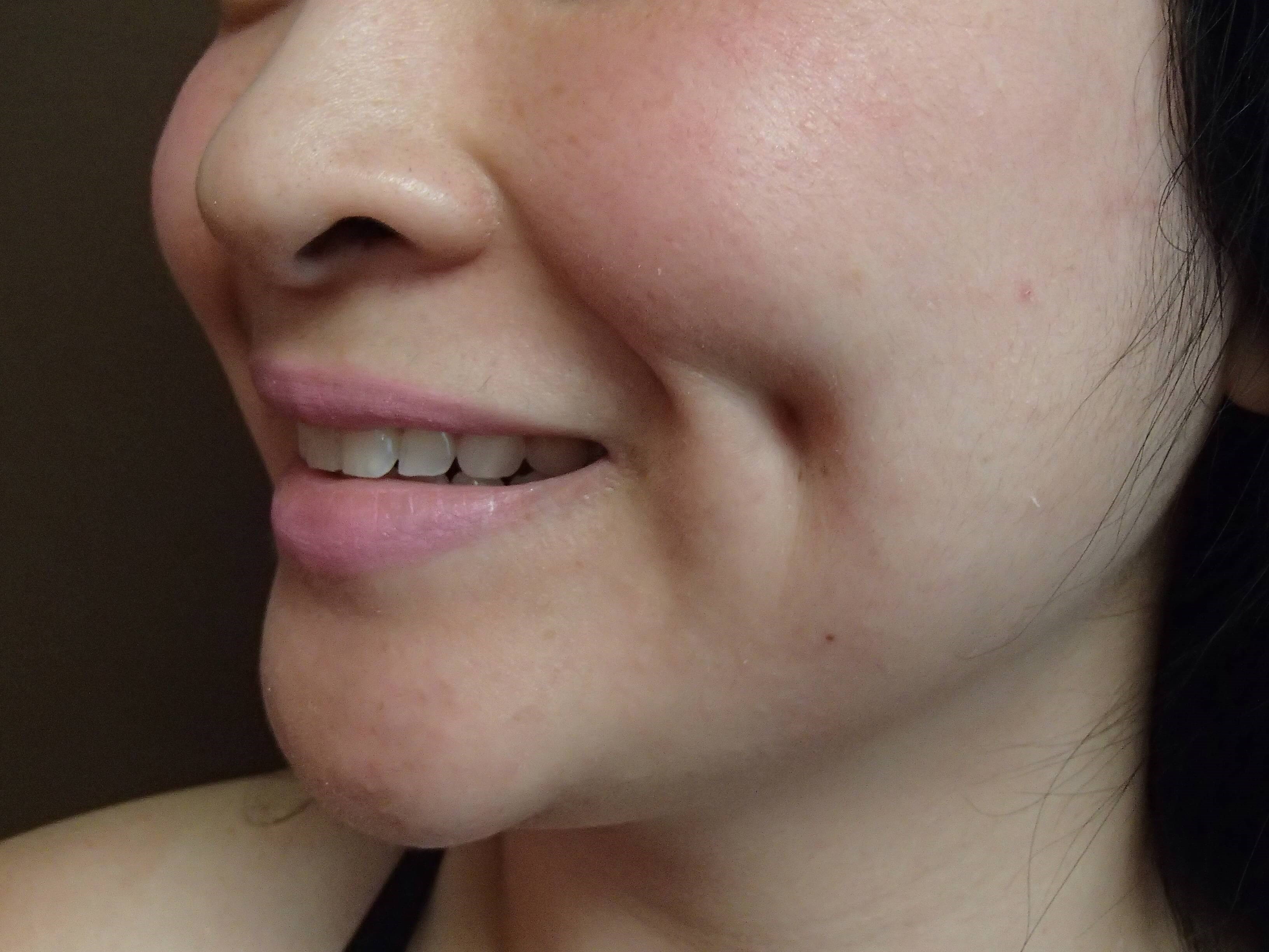 Timeless Dimple After
