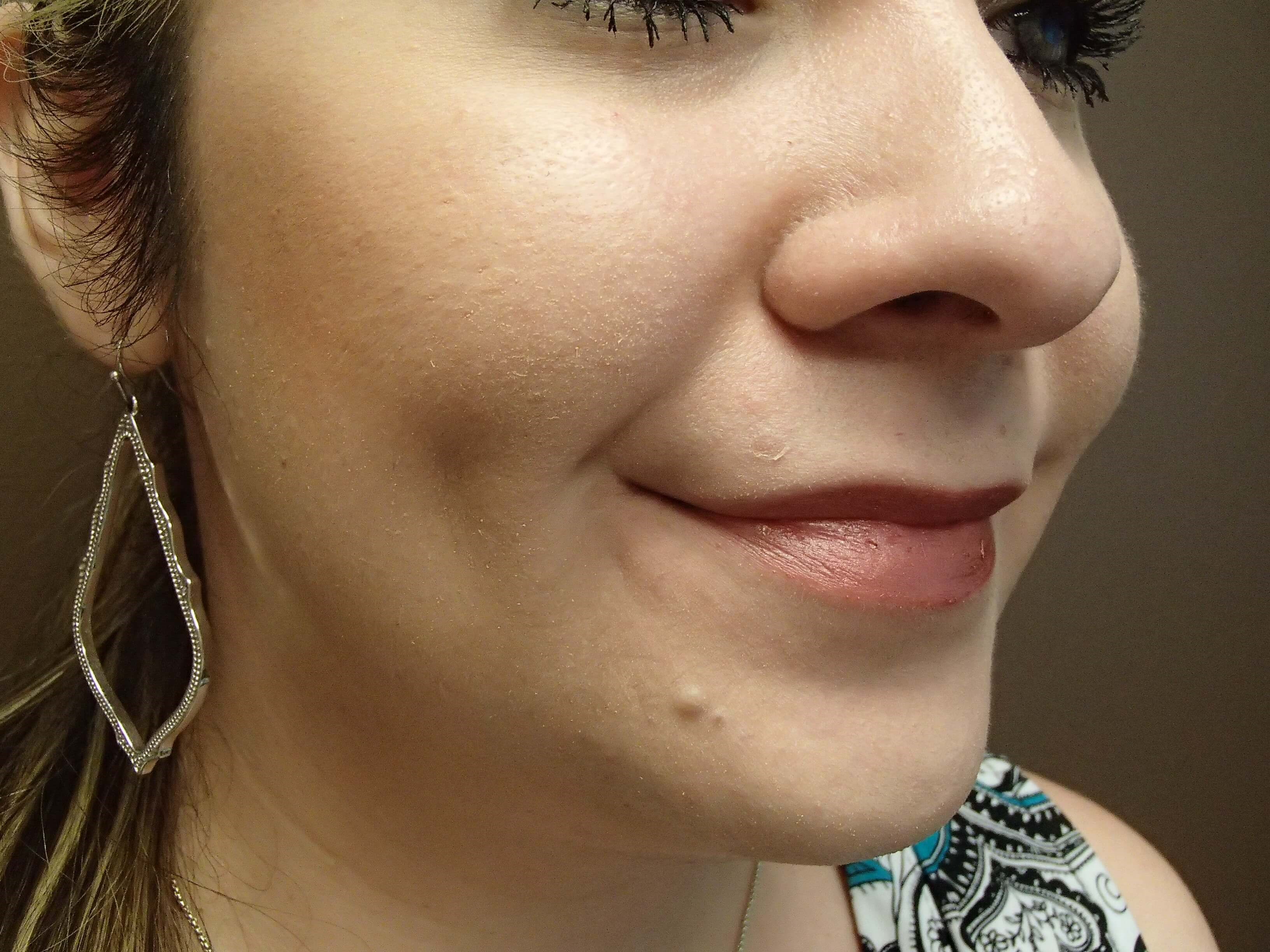 Timeless Dimple After