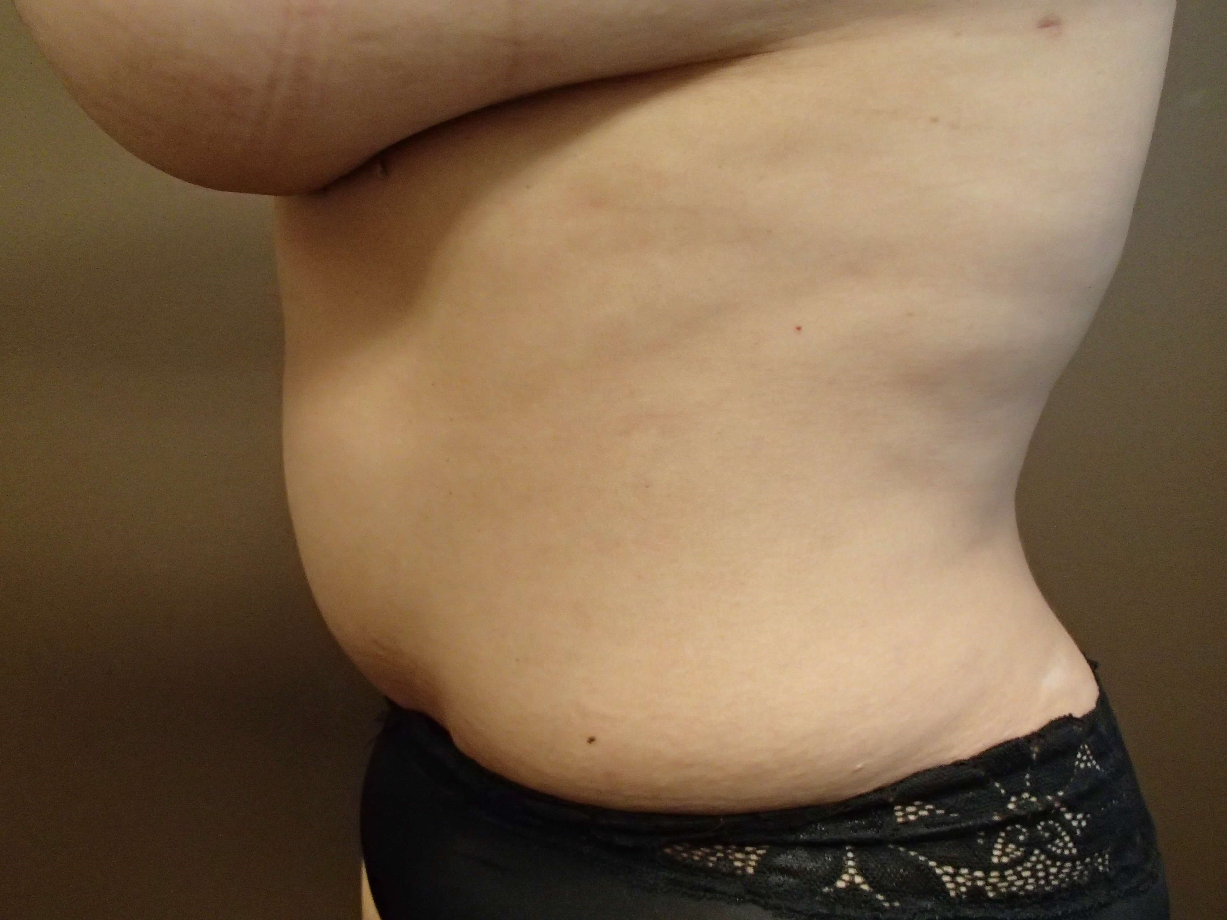 Timeless Tuck After
