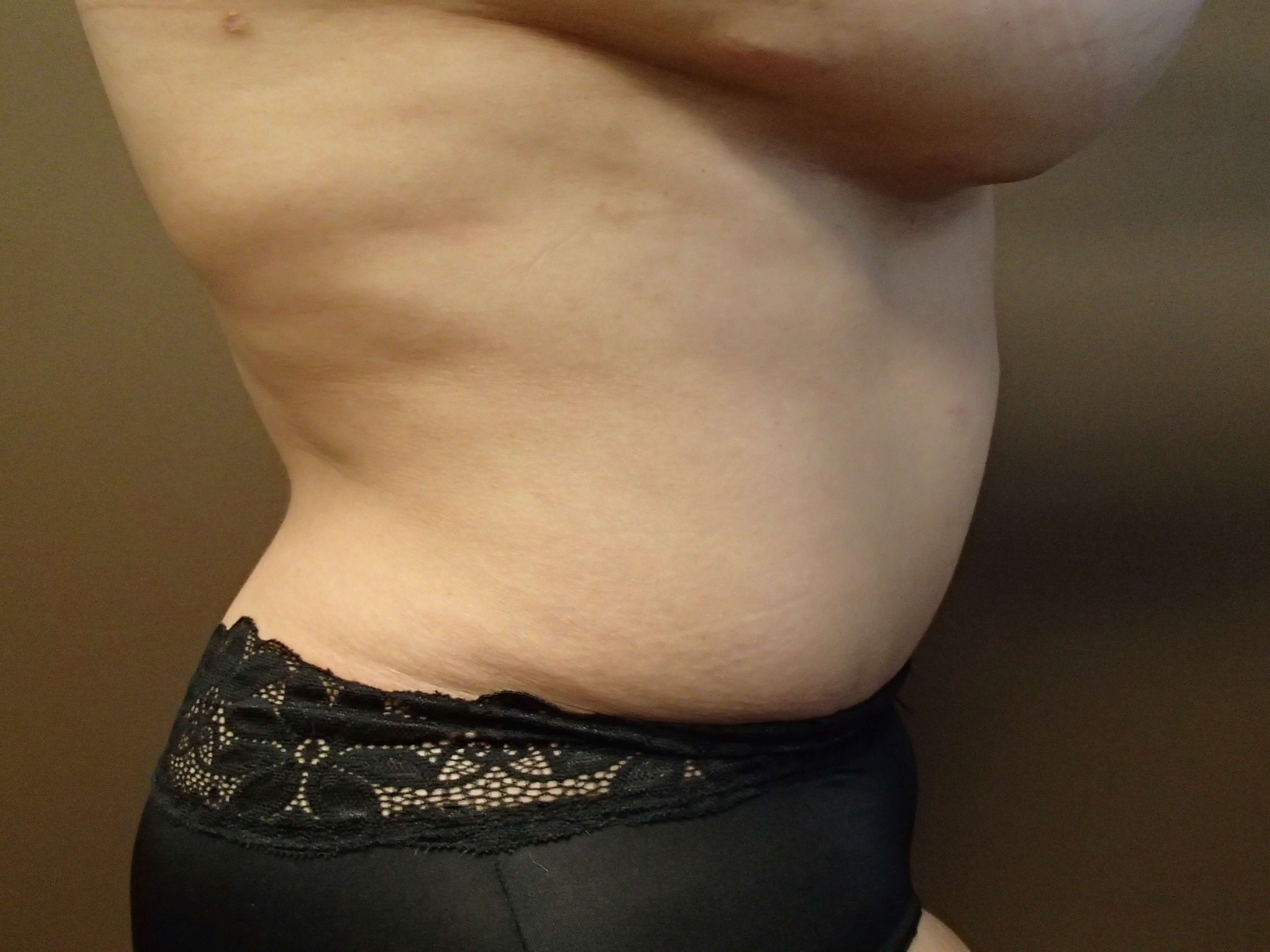 Timeless Tuck After