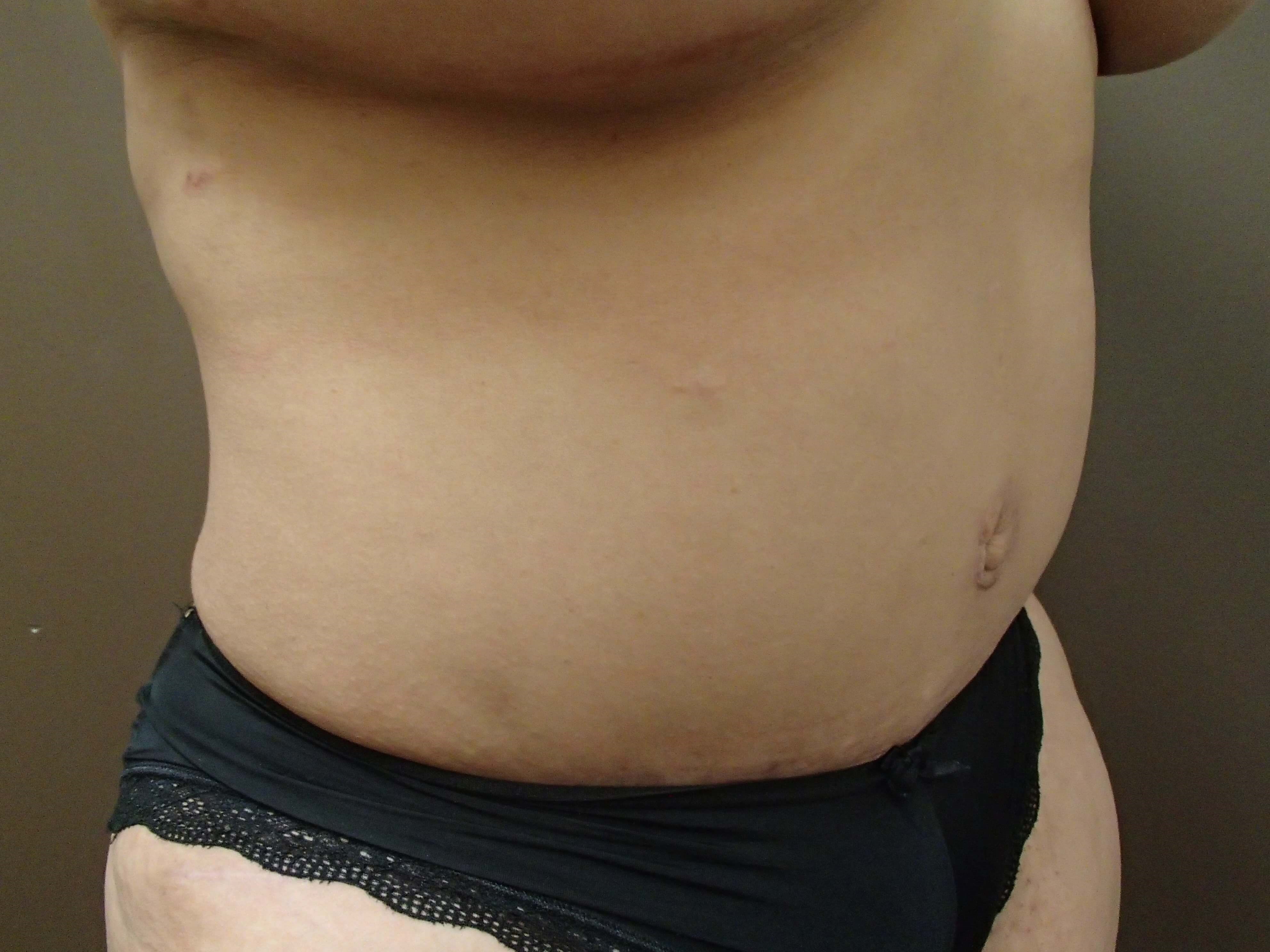 Timeless Tuck After