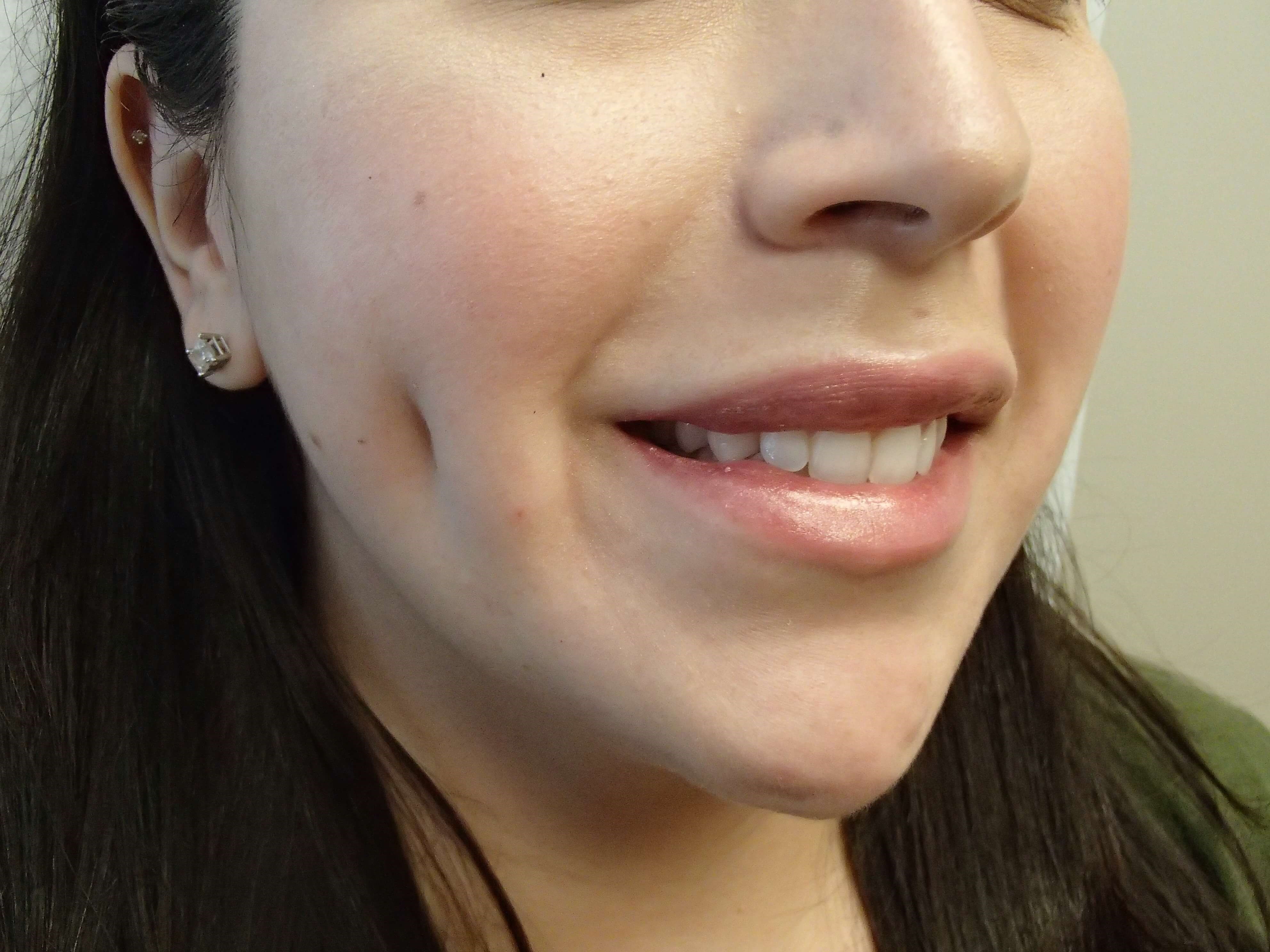 Timeless Dimple After