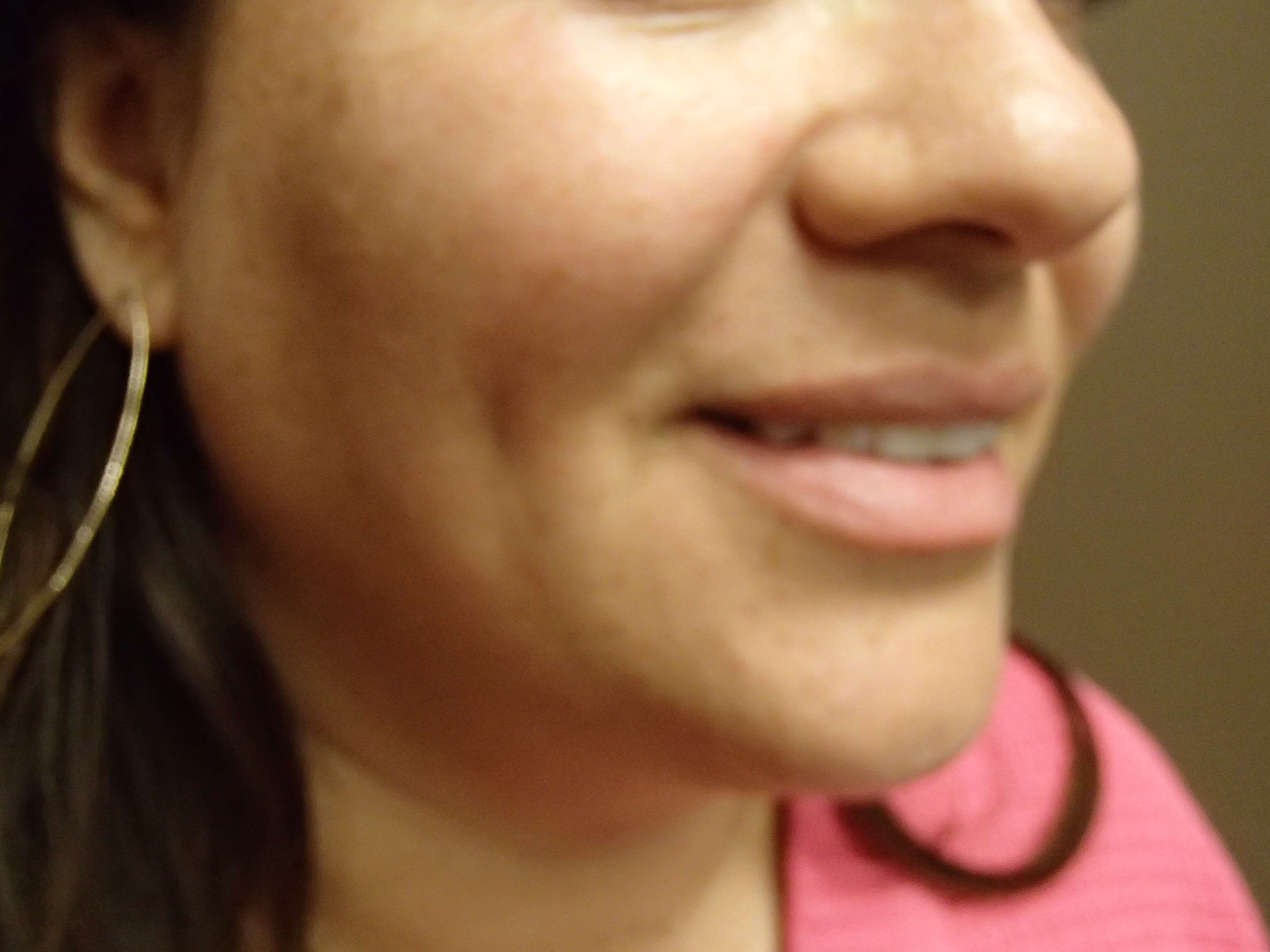 Timeless Dimple After