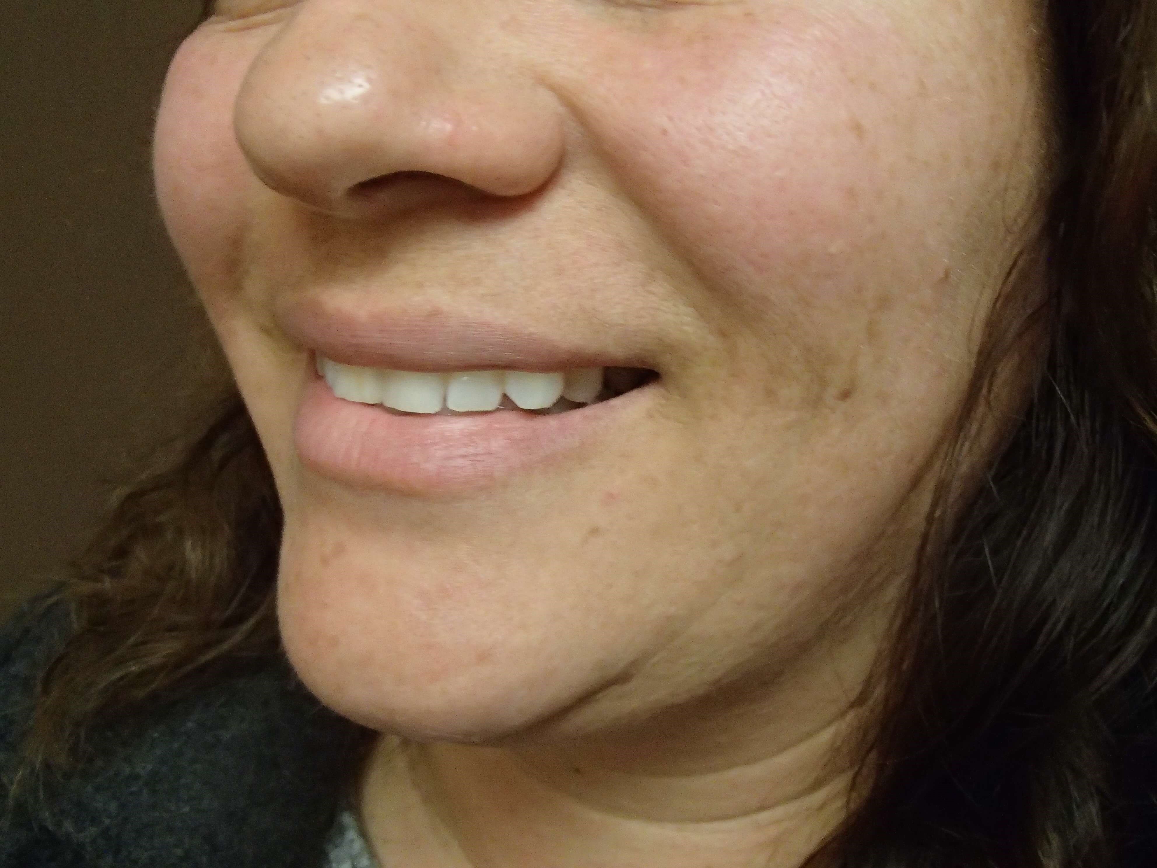 Before Image