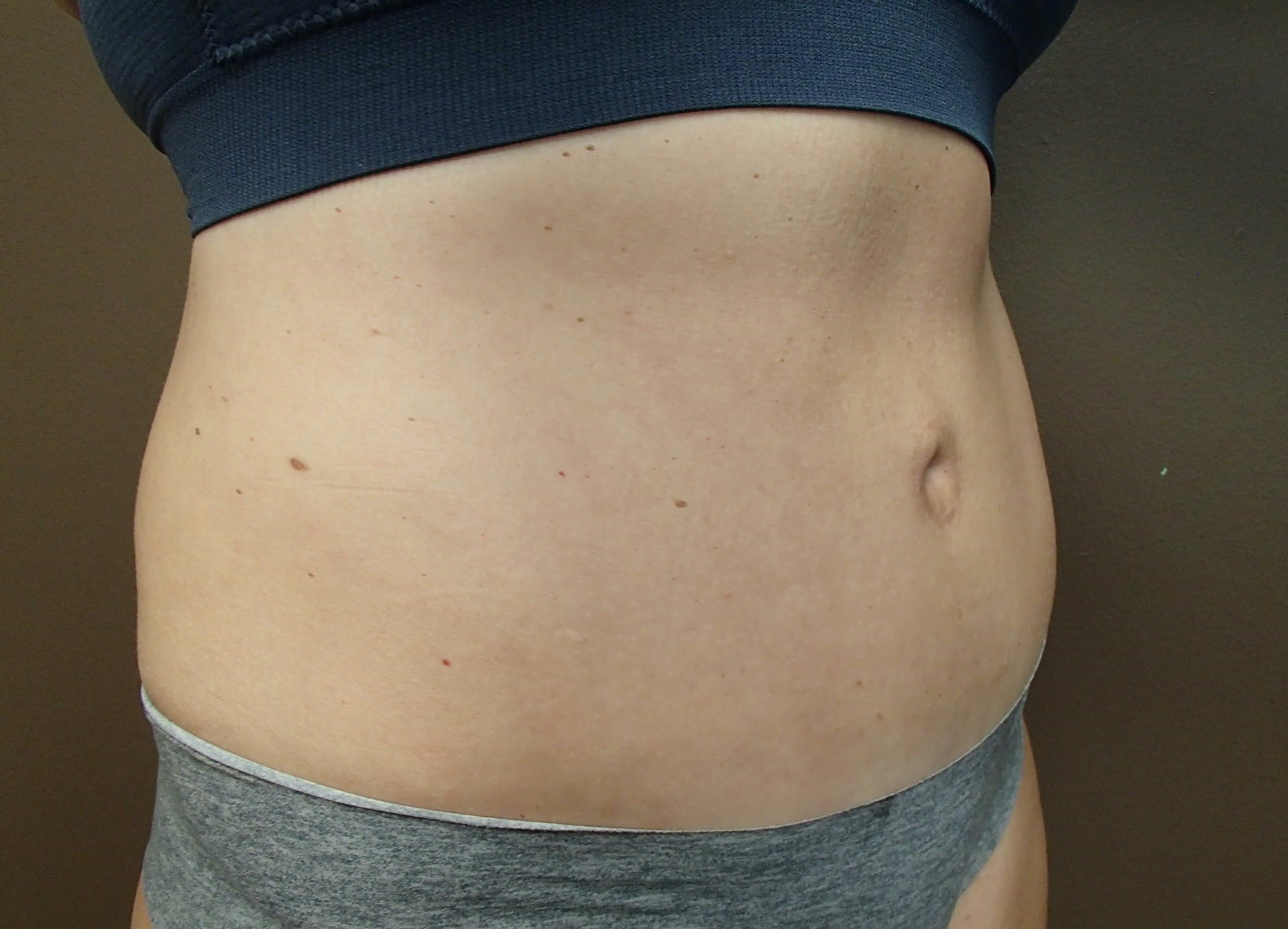 Timeless Tuck After