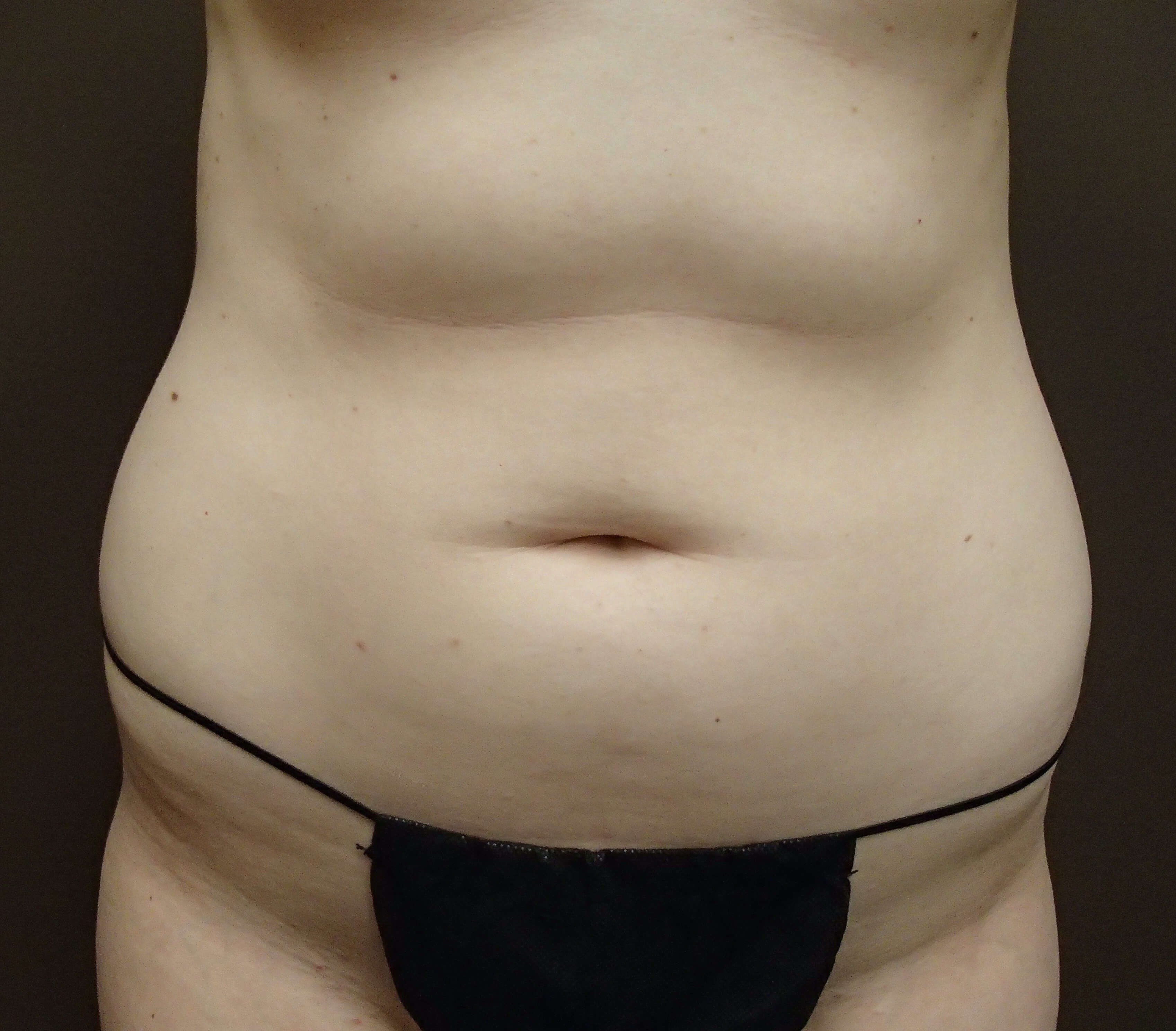 Timeless Tuck Before