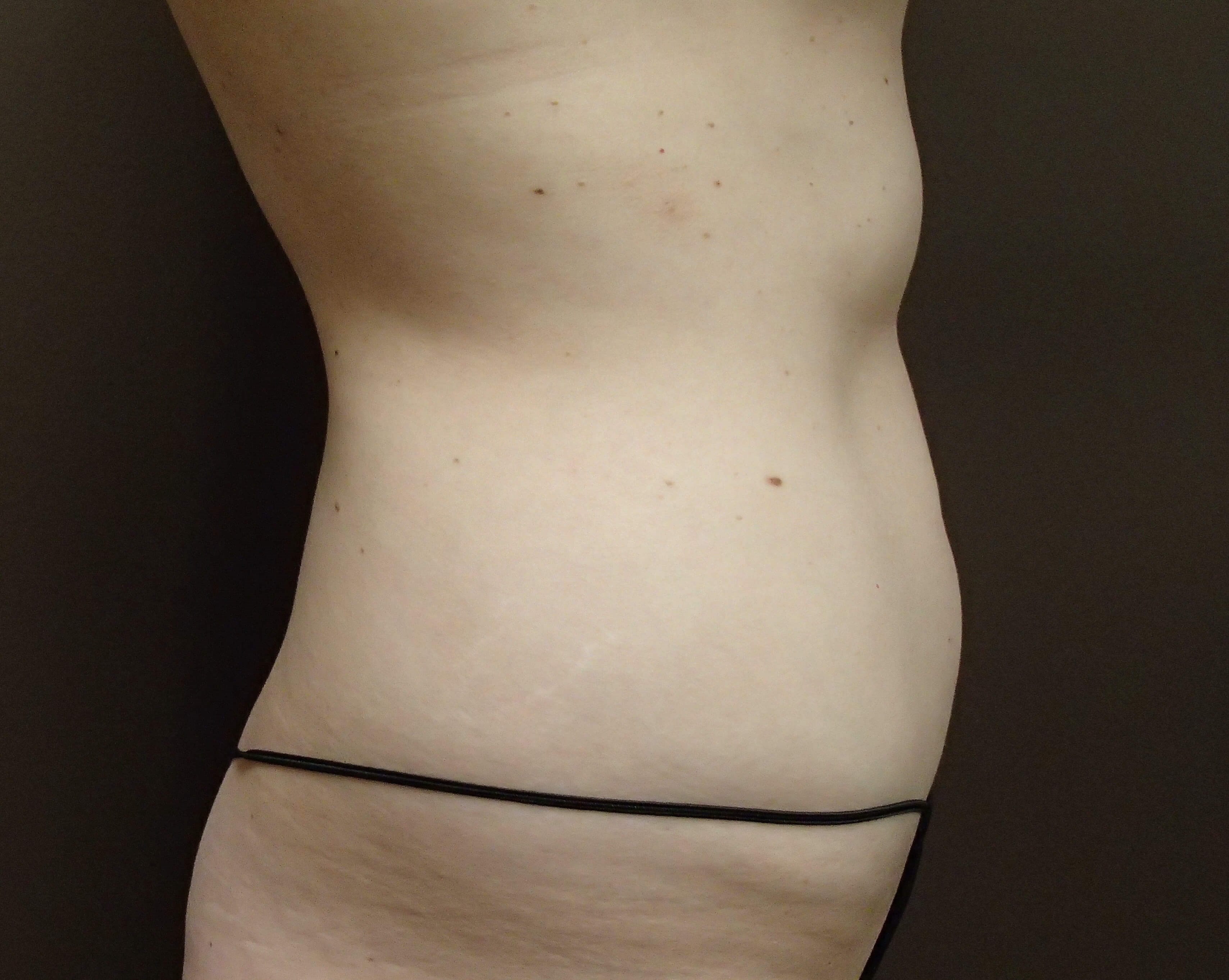 Timeless Tuck Before