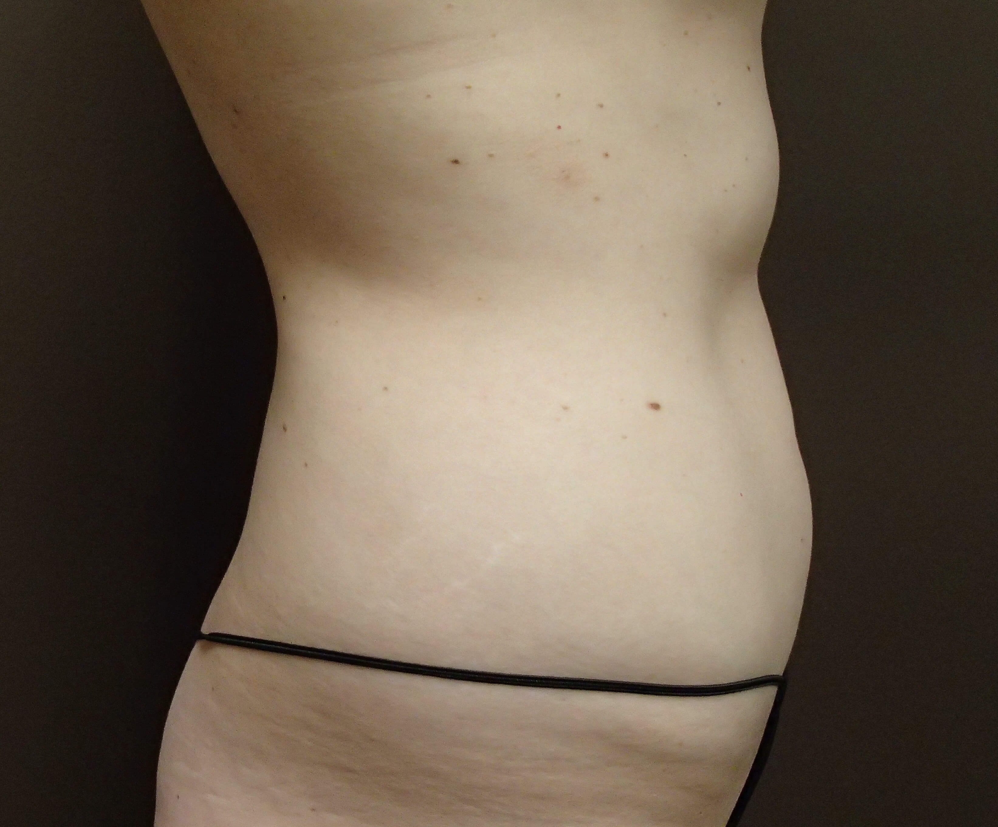 Timeless Tuck Before