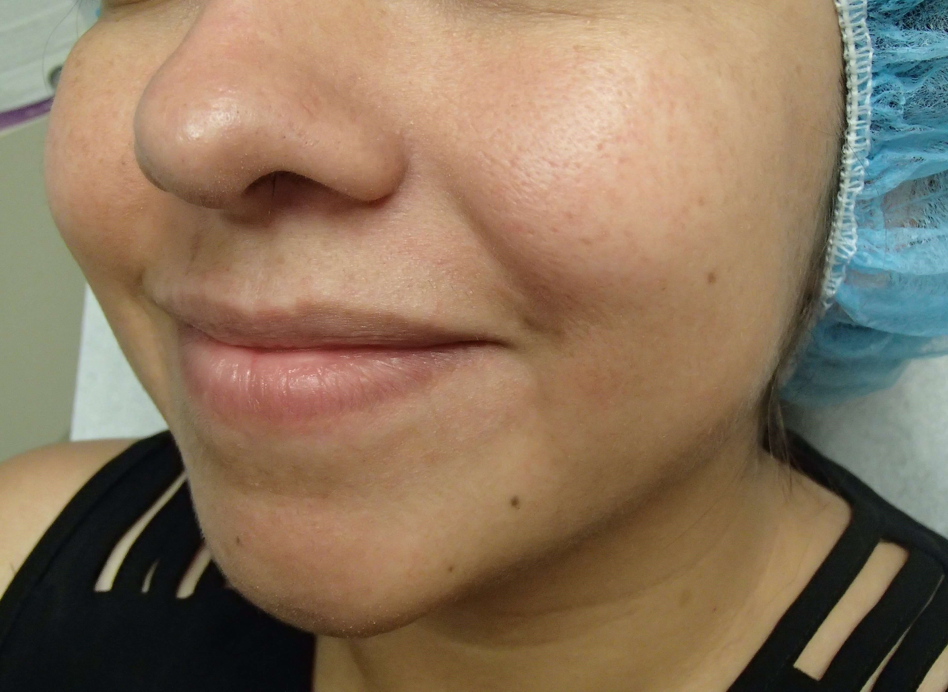 Before Image