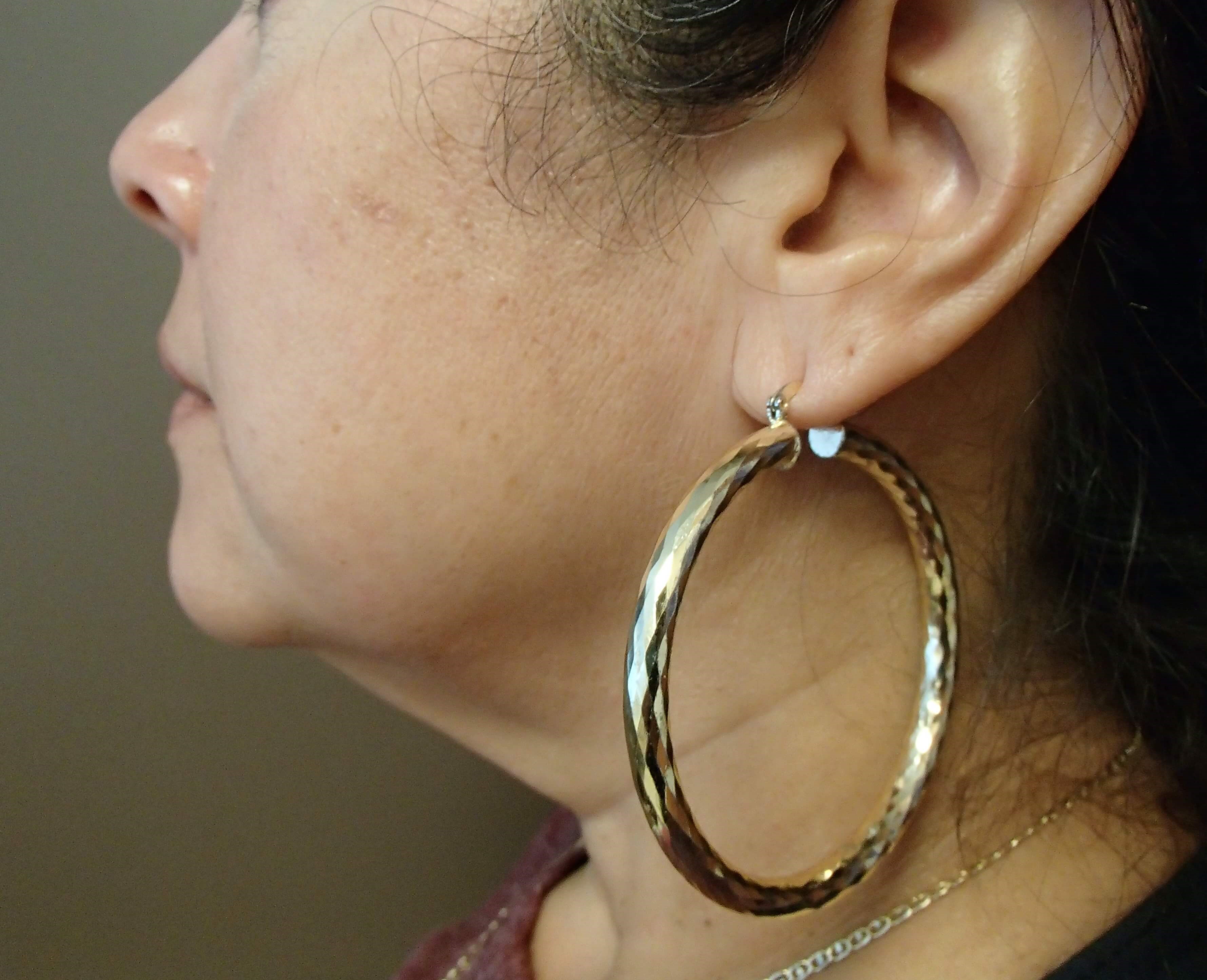 Neck Lift Before