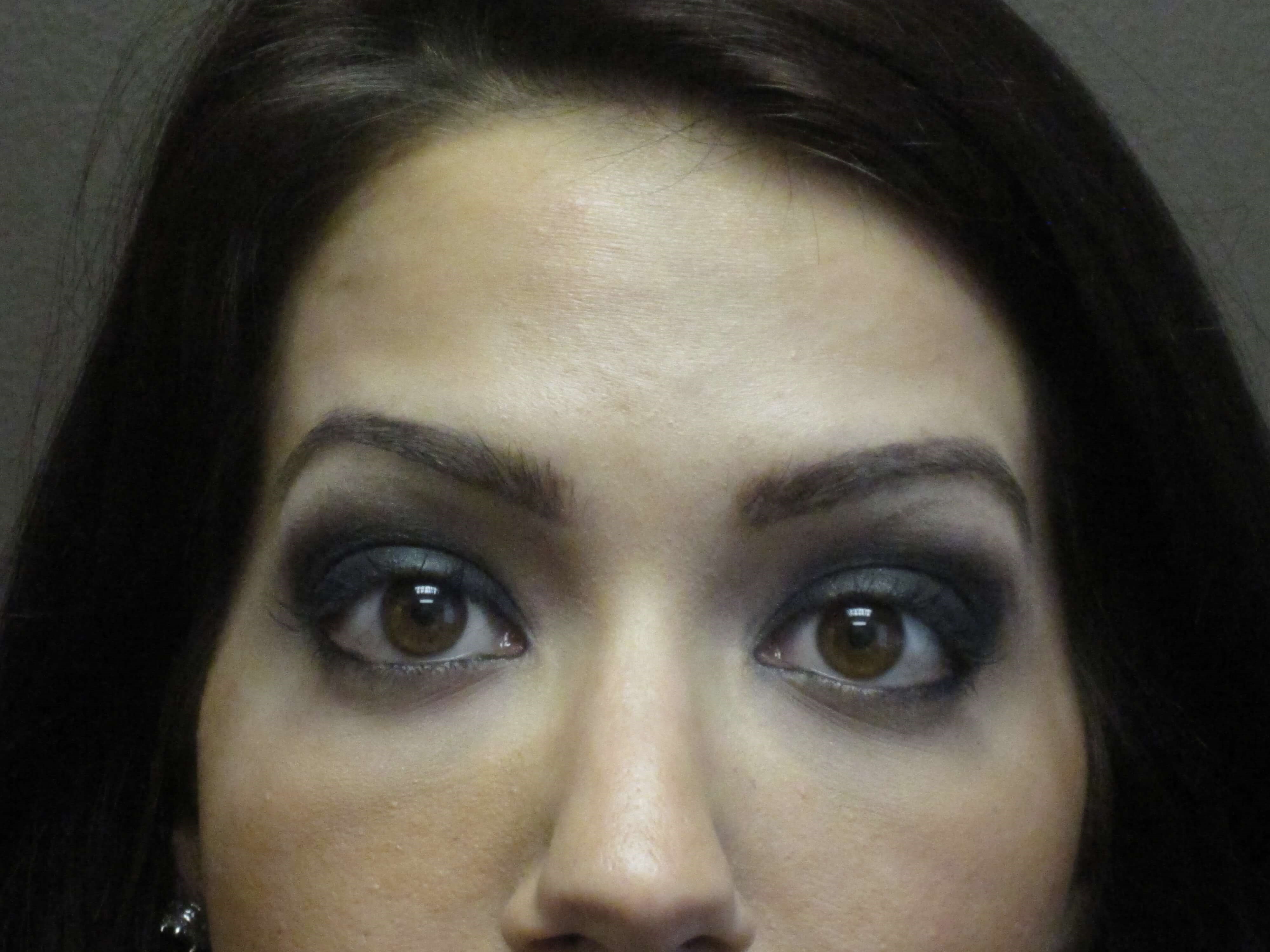 Botox After