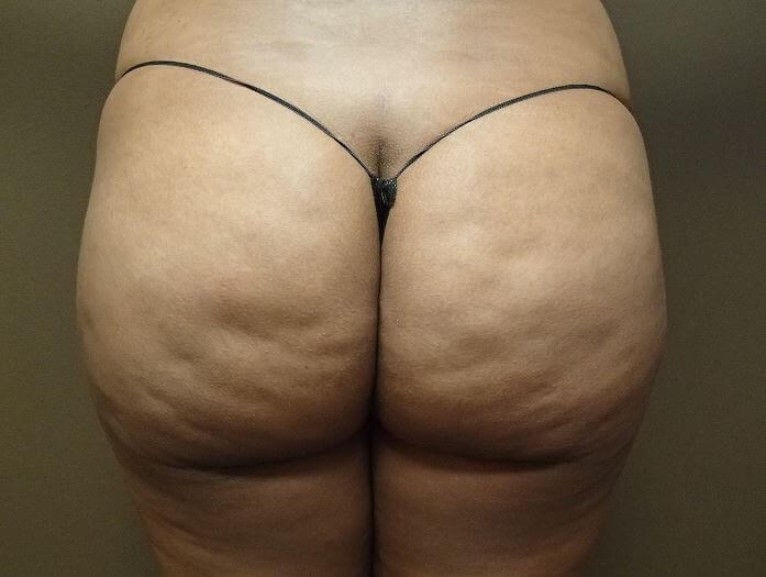 After Image