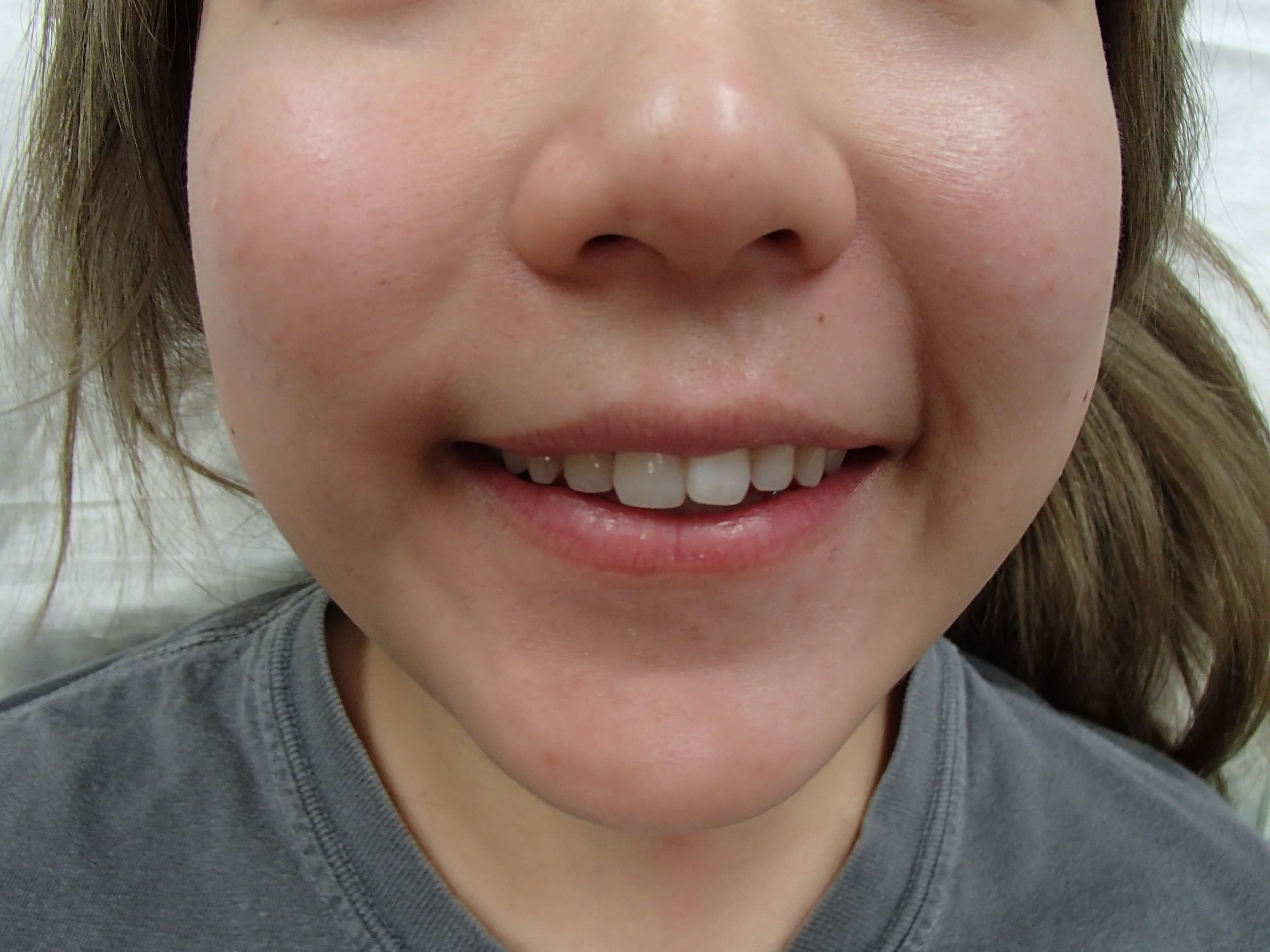 Before Image