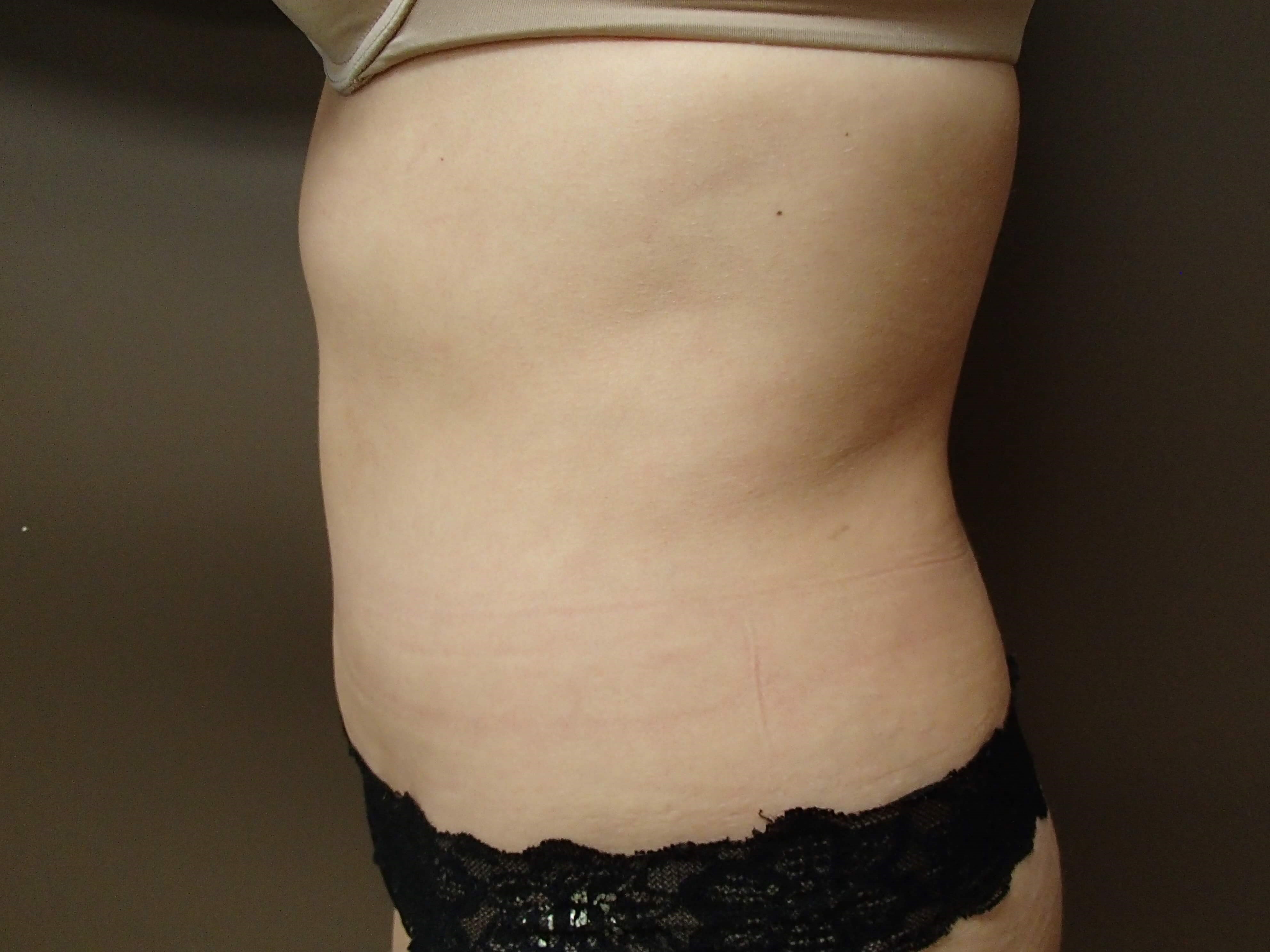Timeless Tuck After