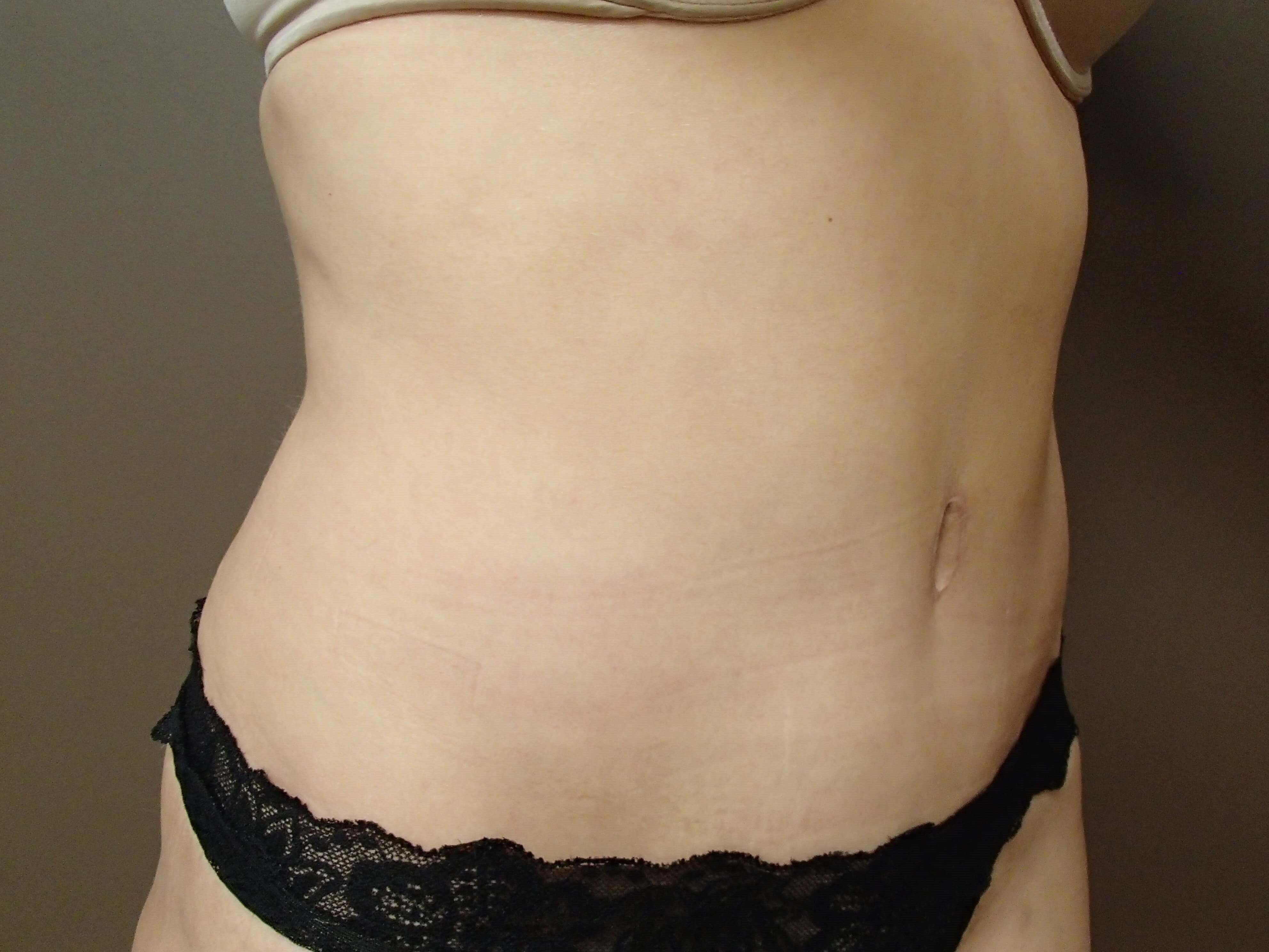 Timeless Tuck After