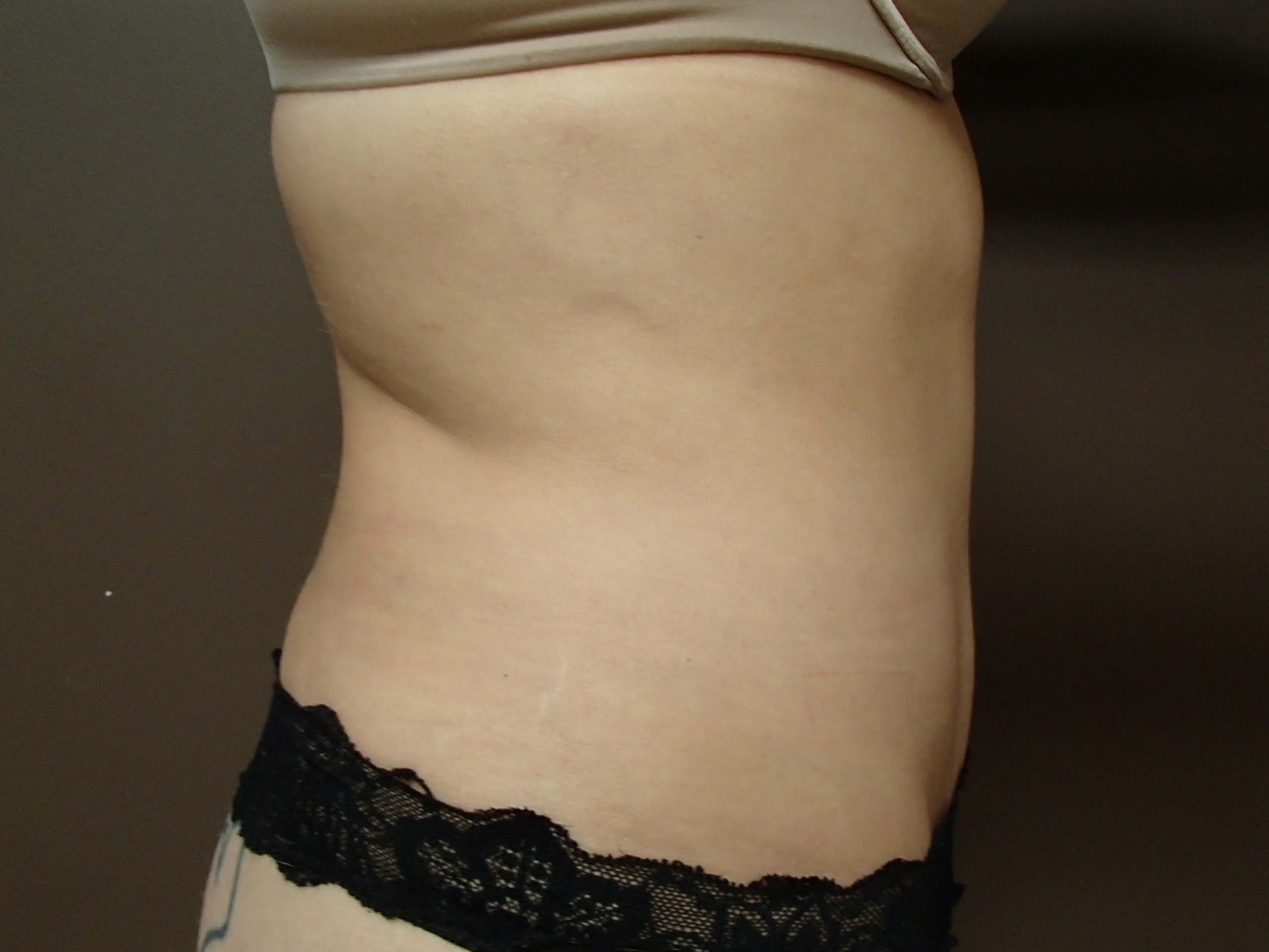 Timeless Tuck After