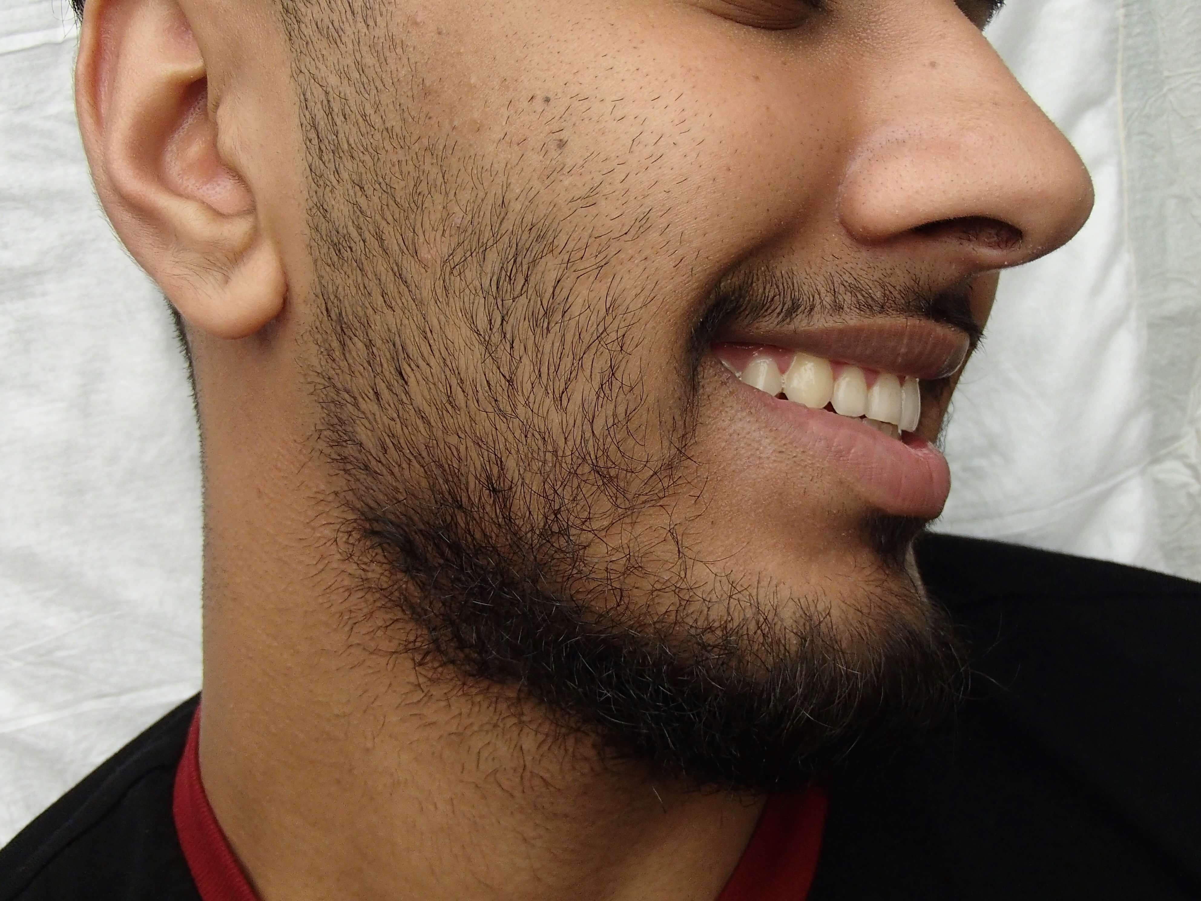Before Image