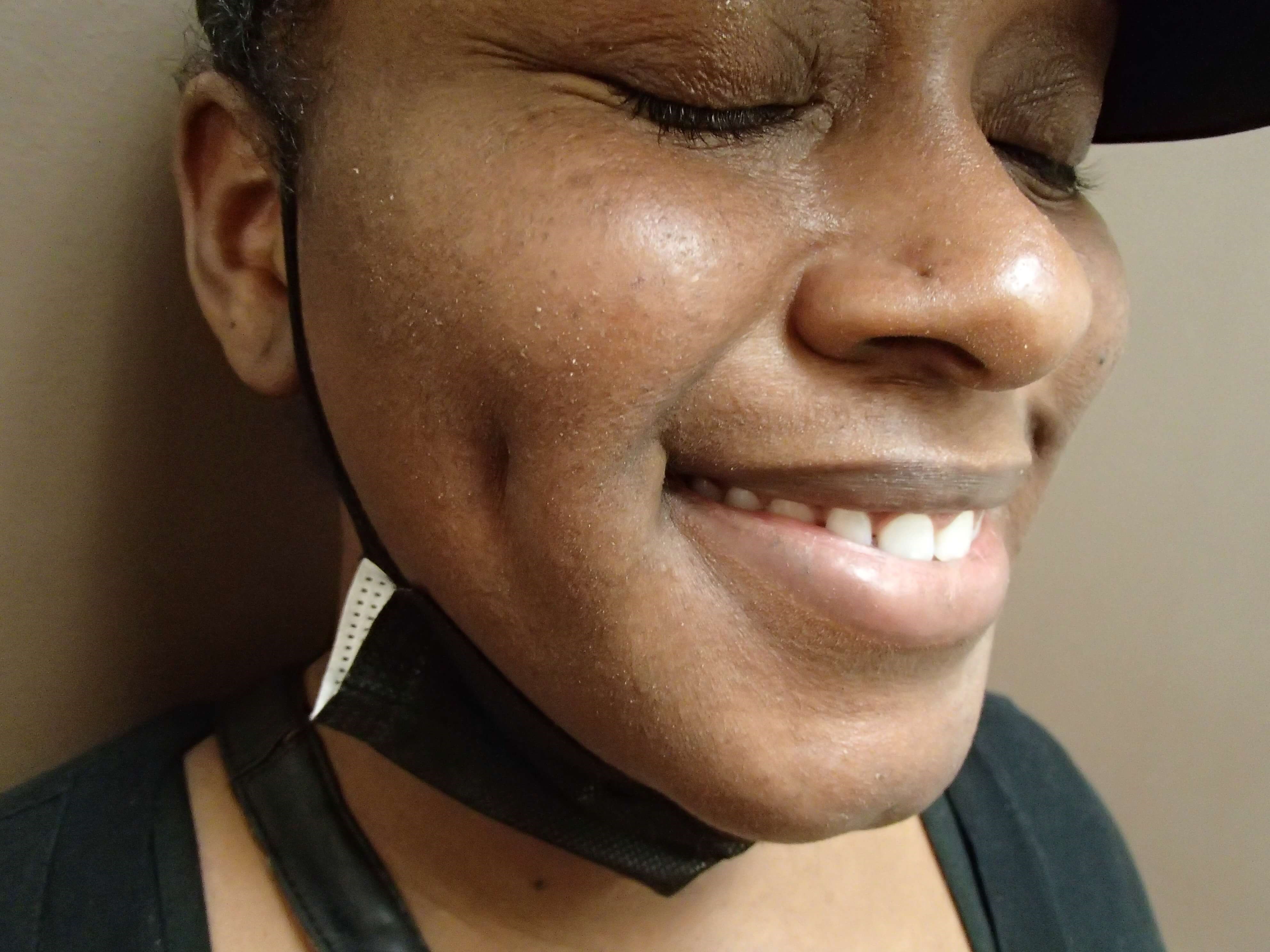 Timeless Dimple After