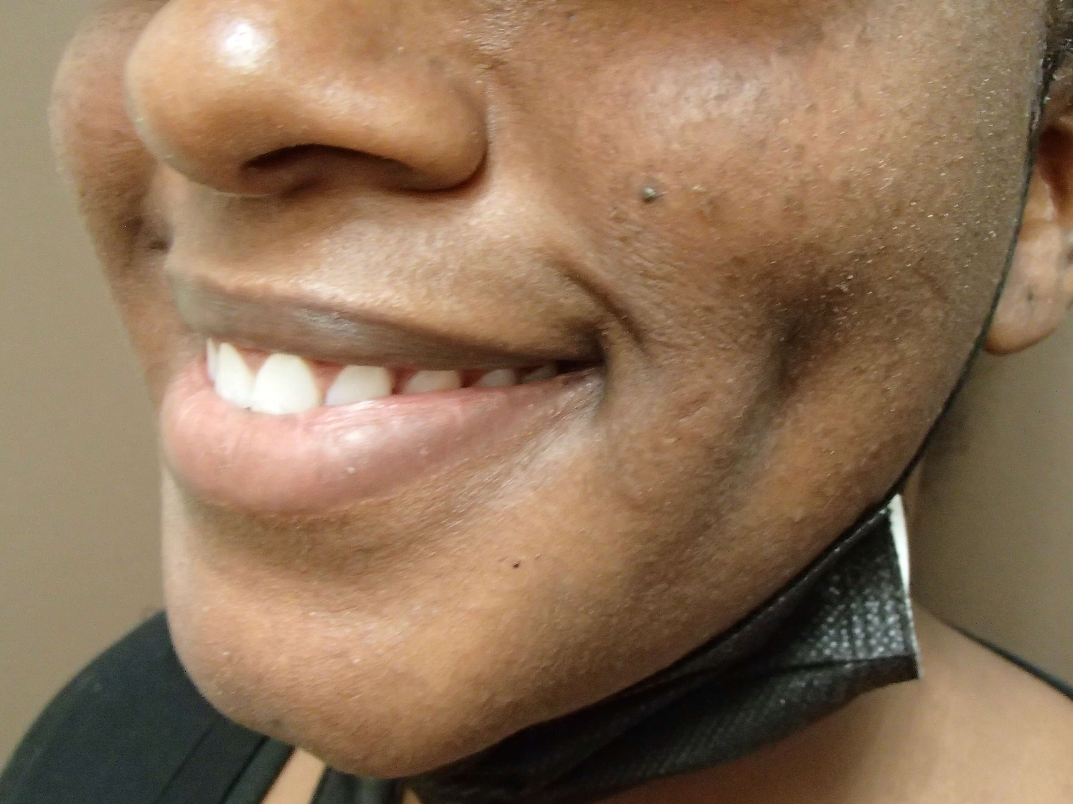 Timeless Dimple After