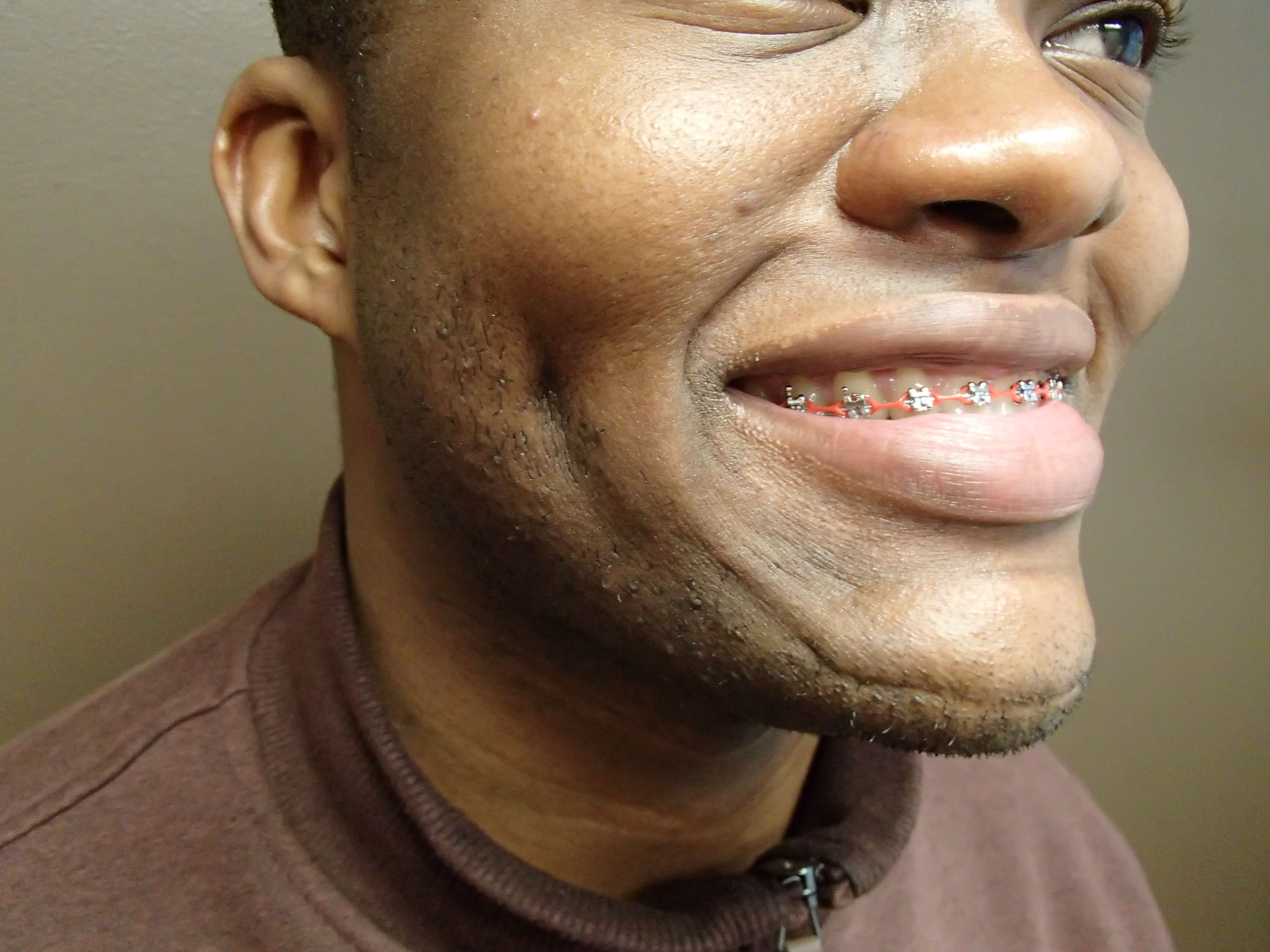 Timeless Dimple After