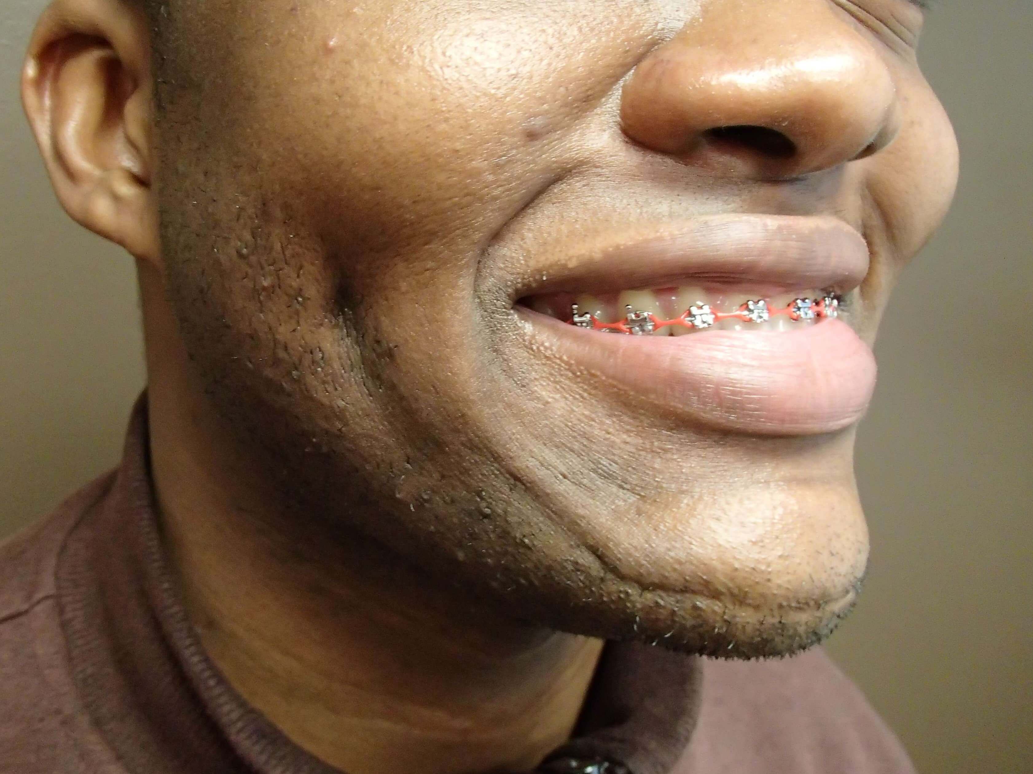 Timeless Dimple After