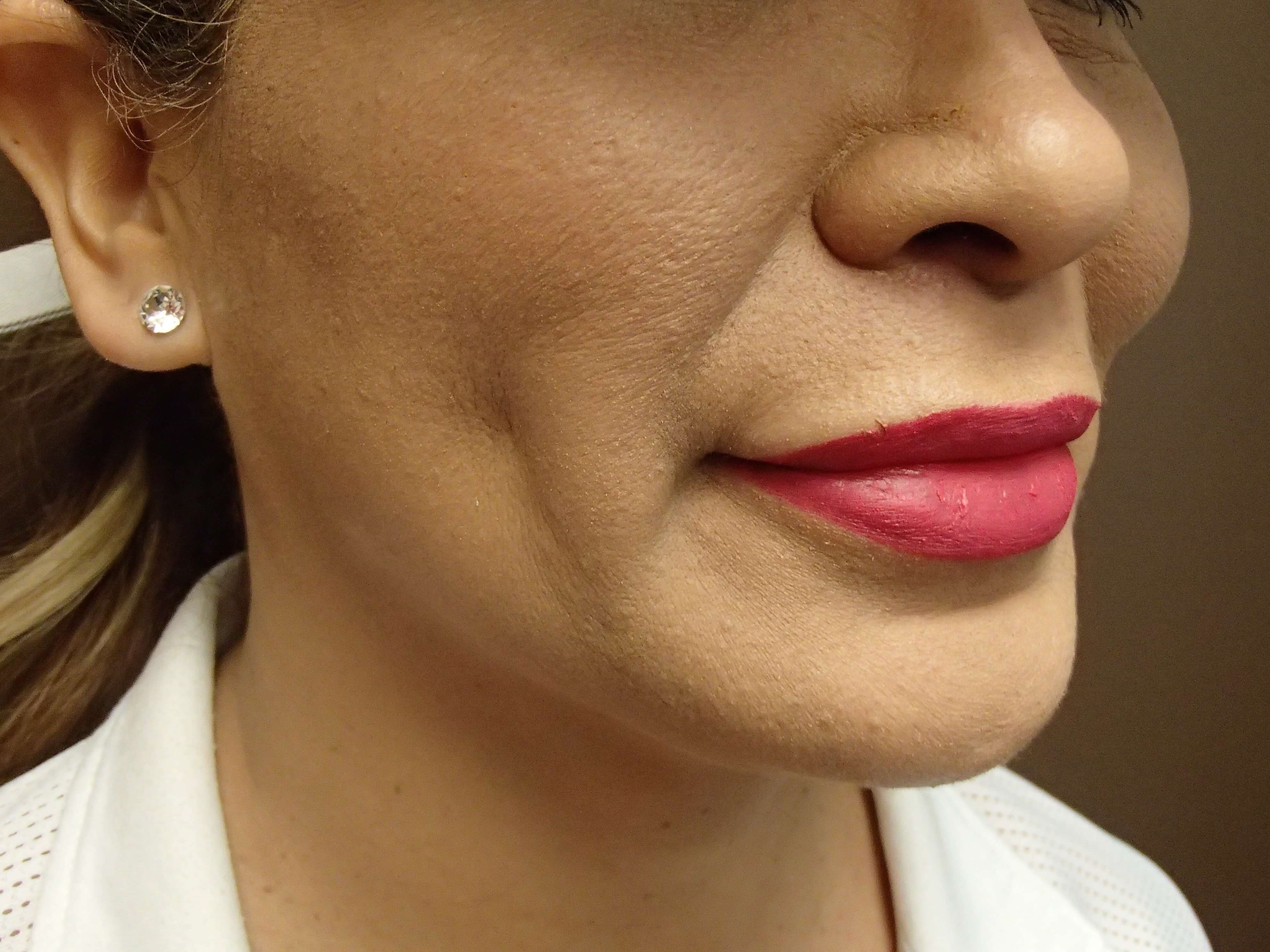 Timeless Dimple After