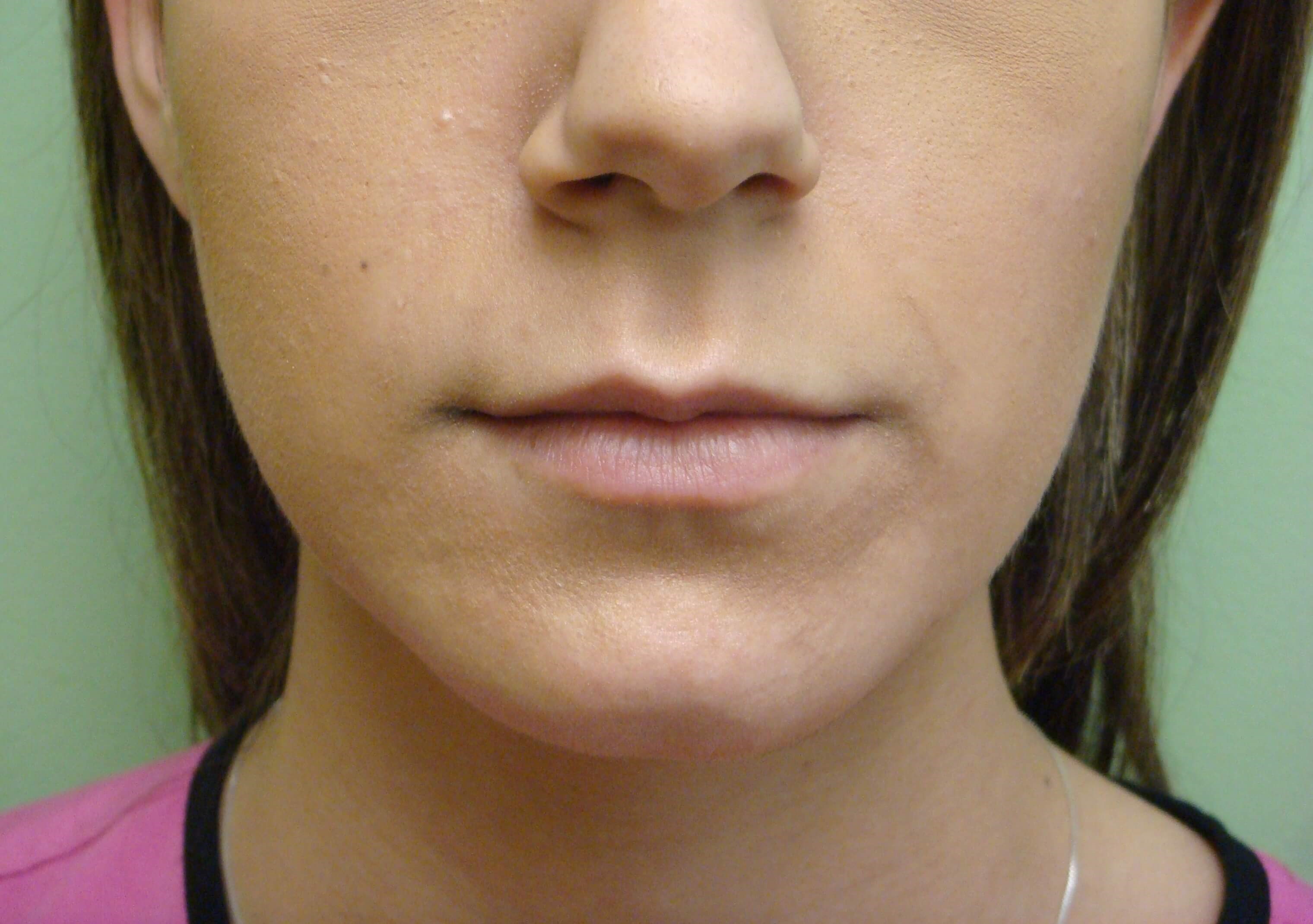 Before Image