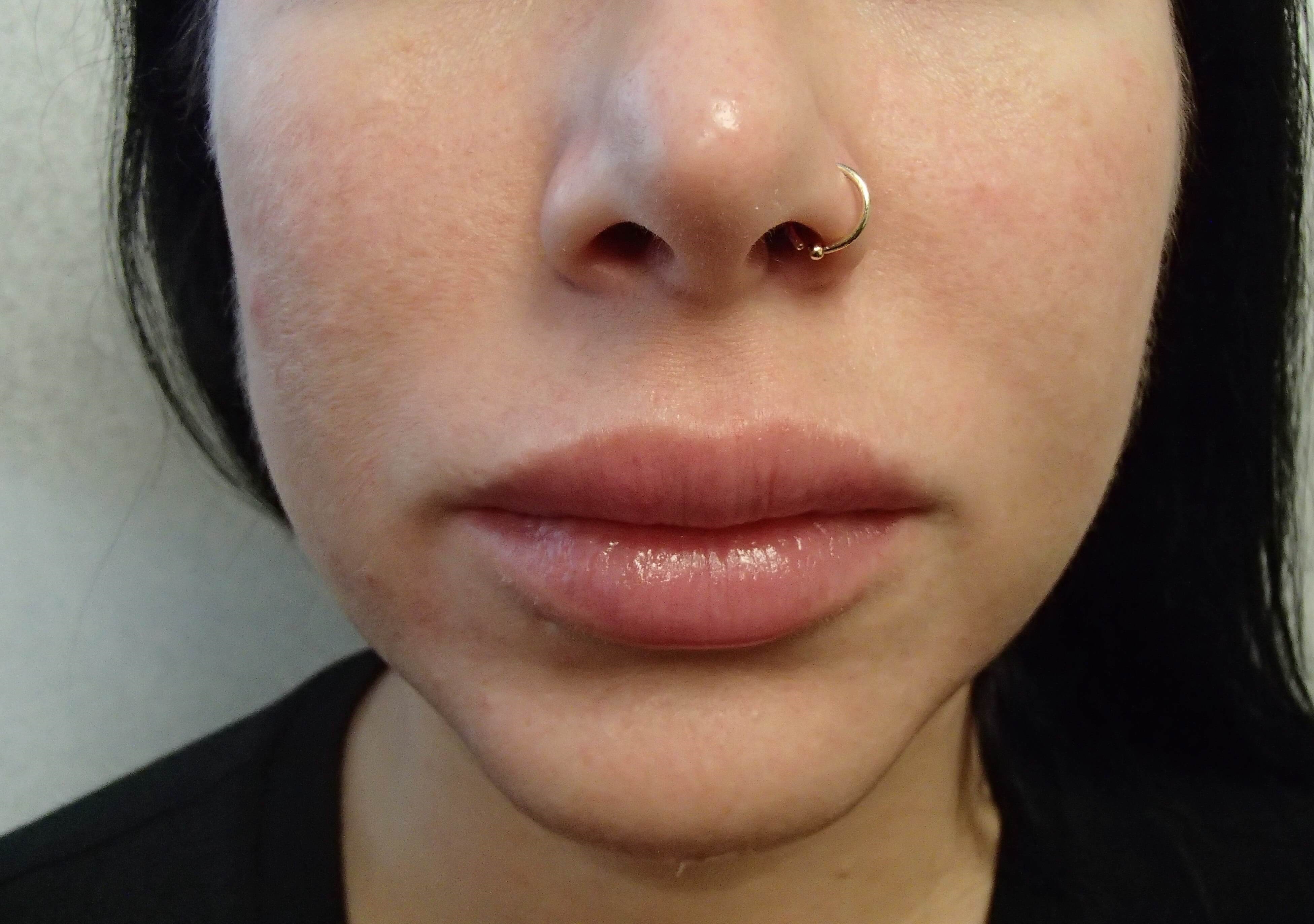 Before Image