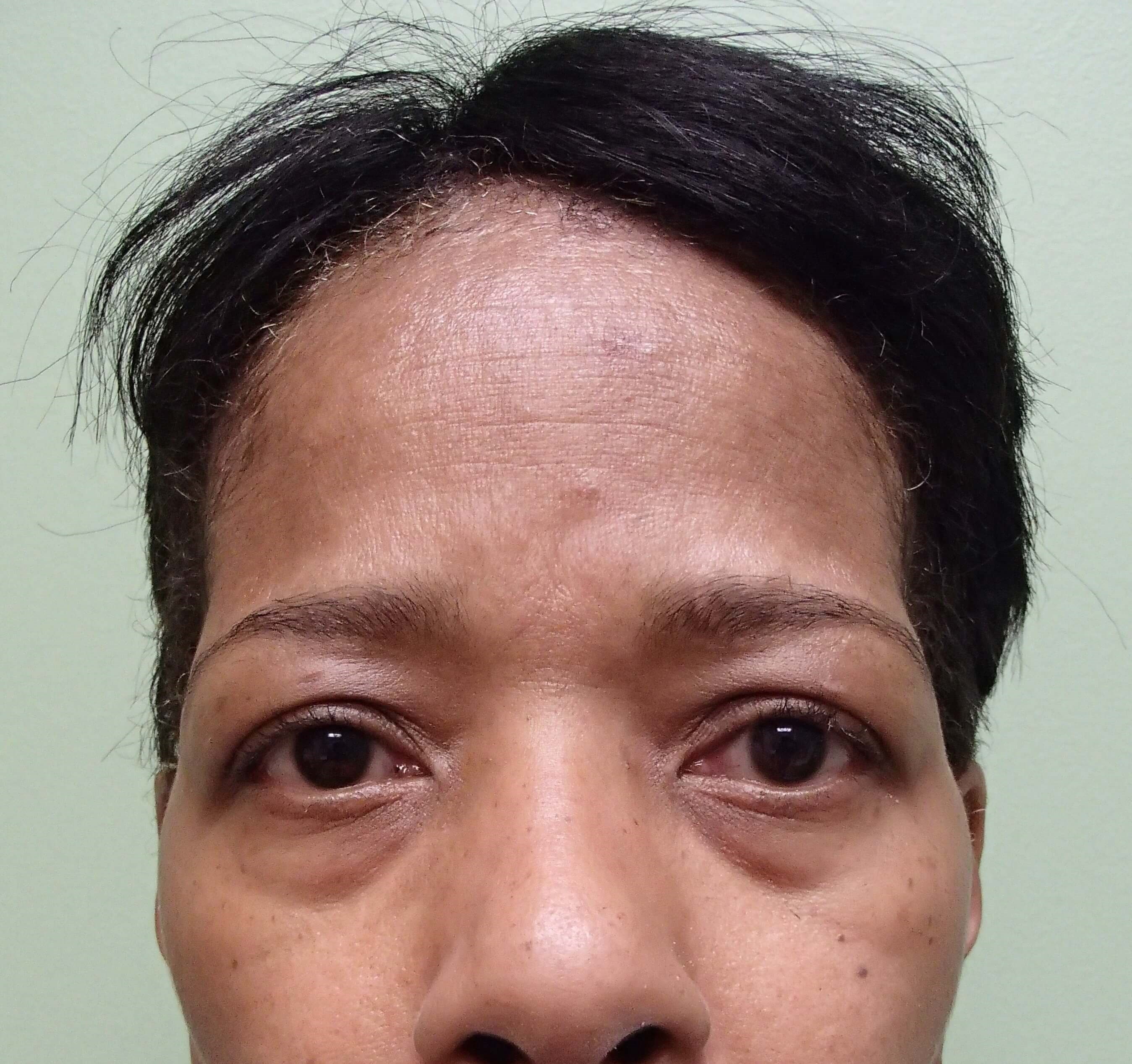 Before Image