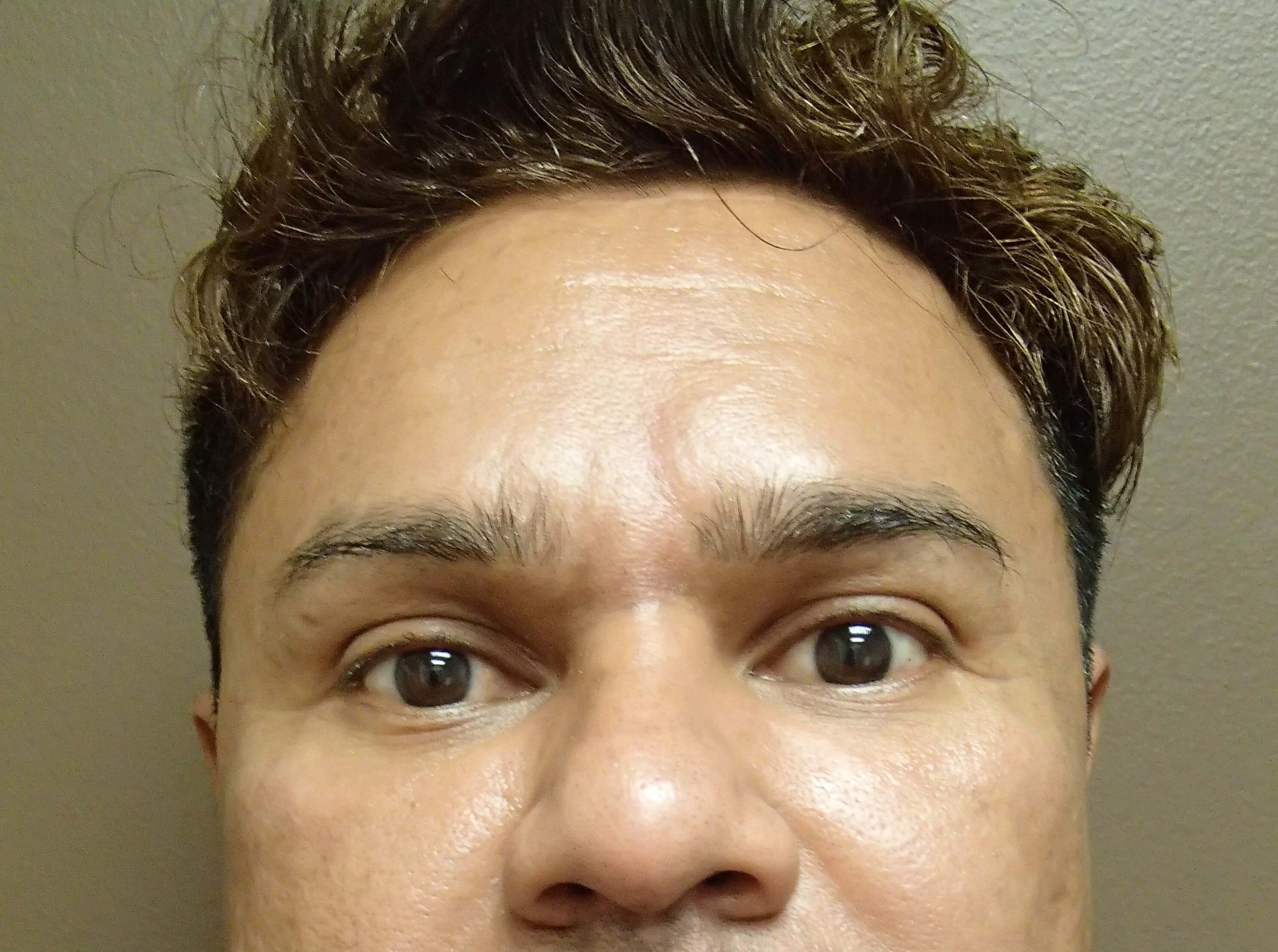 After Image